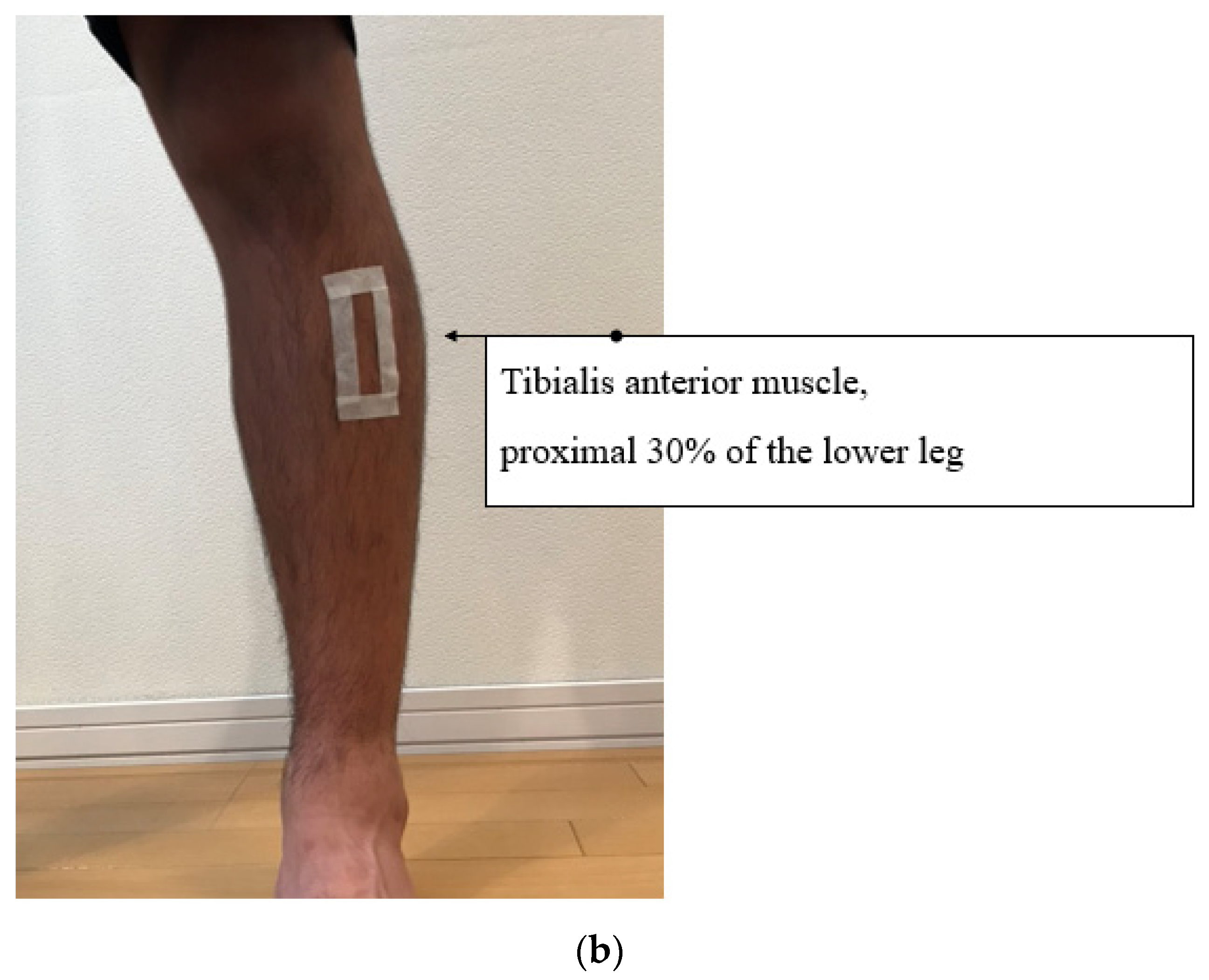 Jcm 11 04024 g003b Jcm 11 04024 g003b