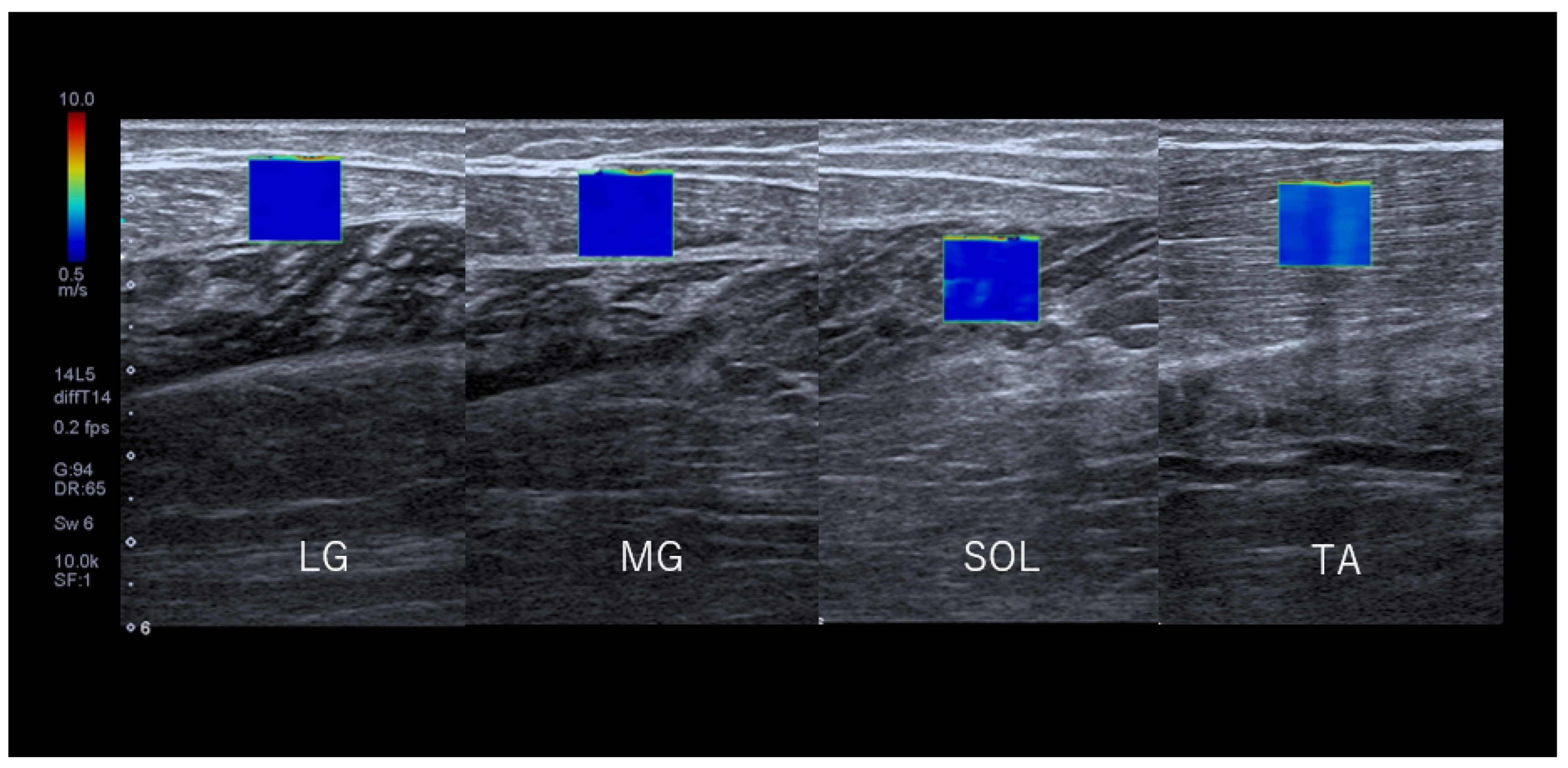 Jcm 11 04024 g004 Jcm 11 04024 g004