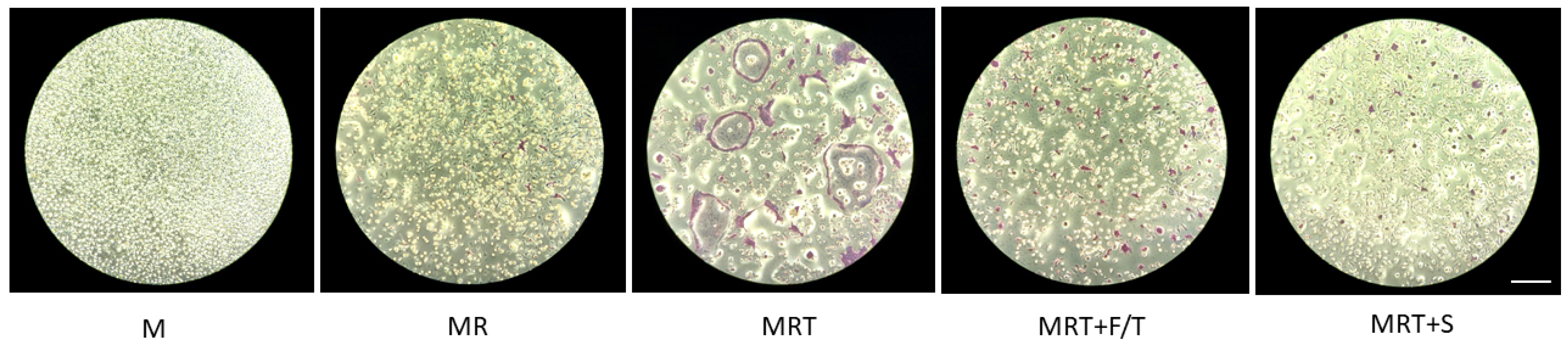 Jcm 11 04061 g006 550