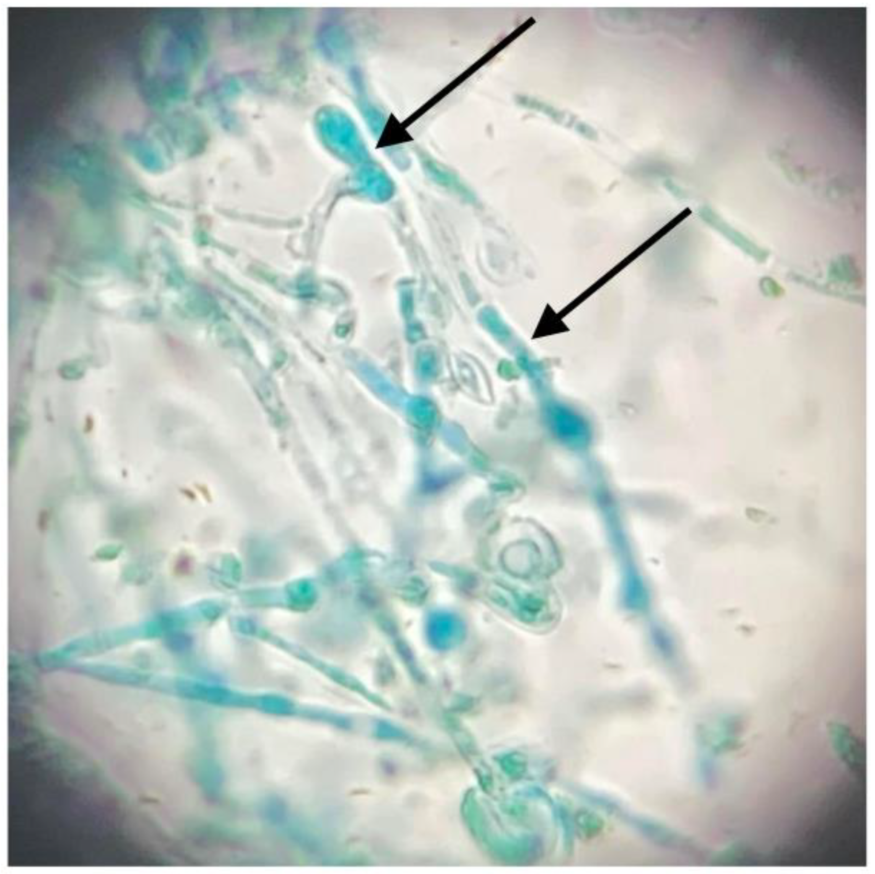 Jcm 11 04066 g004 Jcm 11 04066 g004