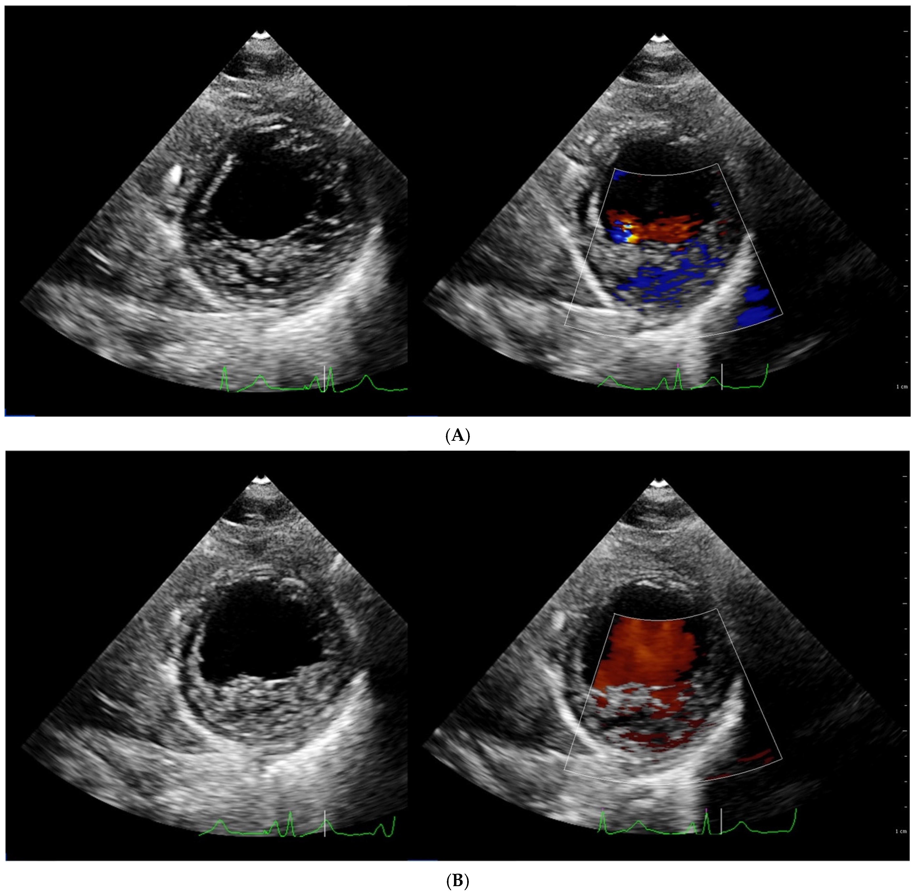 Jcm 11 04135 g001a Jcm 11 04135 g001a