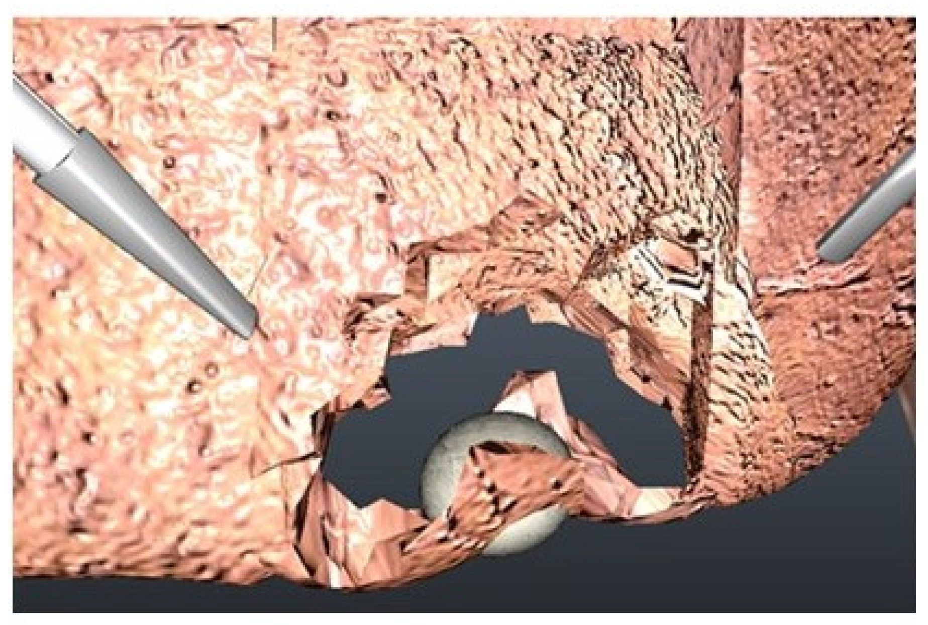 Jcm 11 04145 g003 550