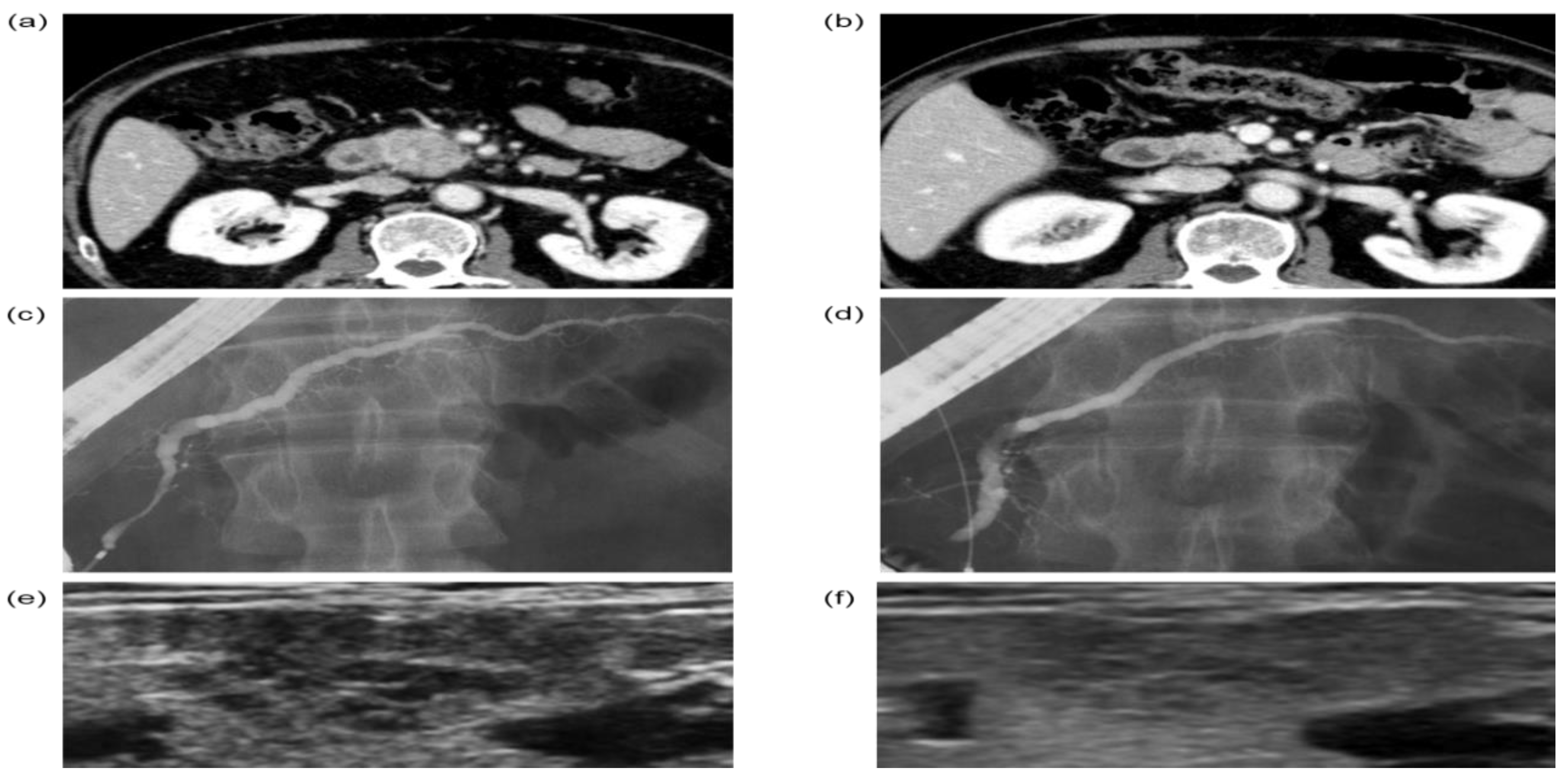 Jcm 11 04189 g003 Jcm 11 04189 g003