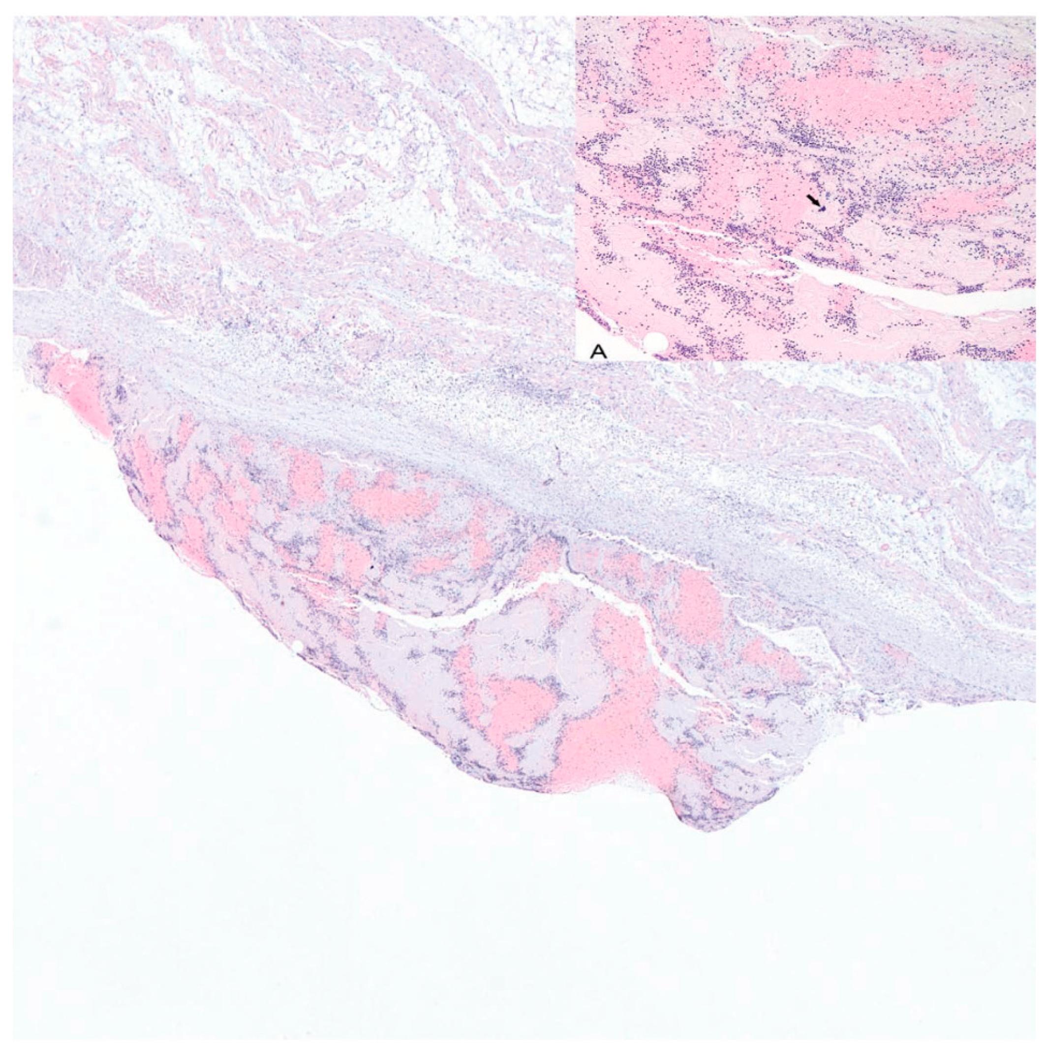 Jcm 11 04208 g001 550