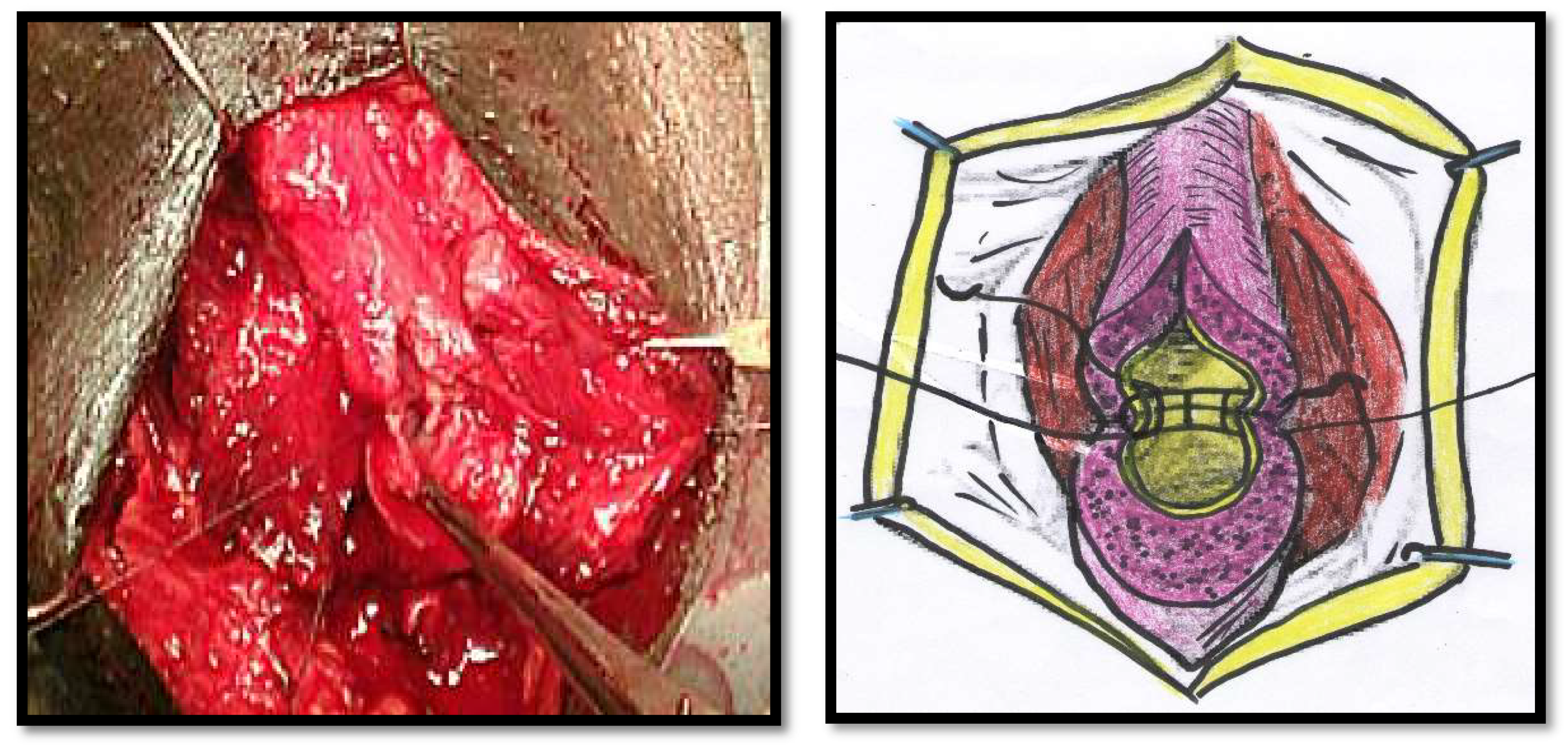 Jcm 11 04252 g001 550