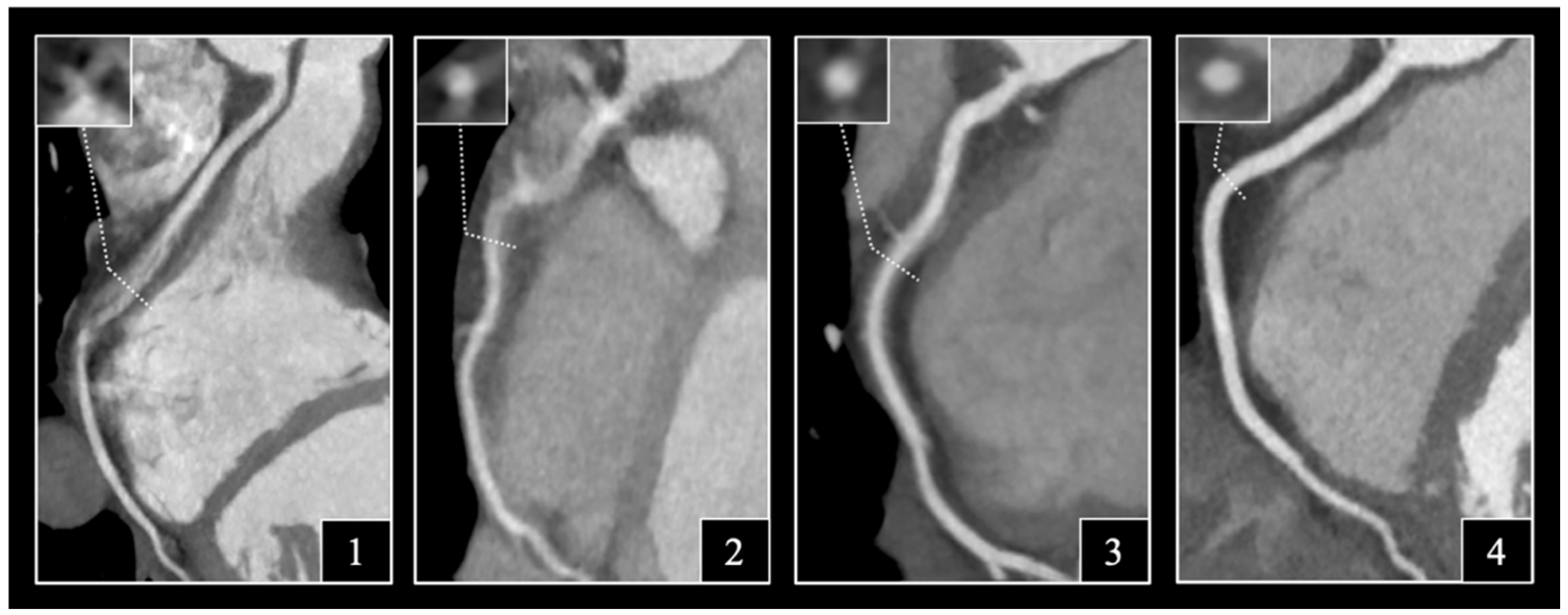 Jcm 11 04336 g002 550