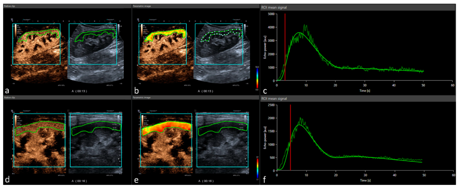 Jcm 11 04354 g001 Jcm 11 04354 g001