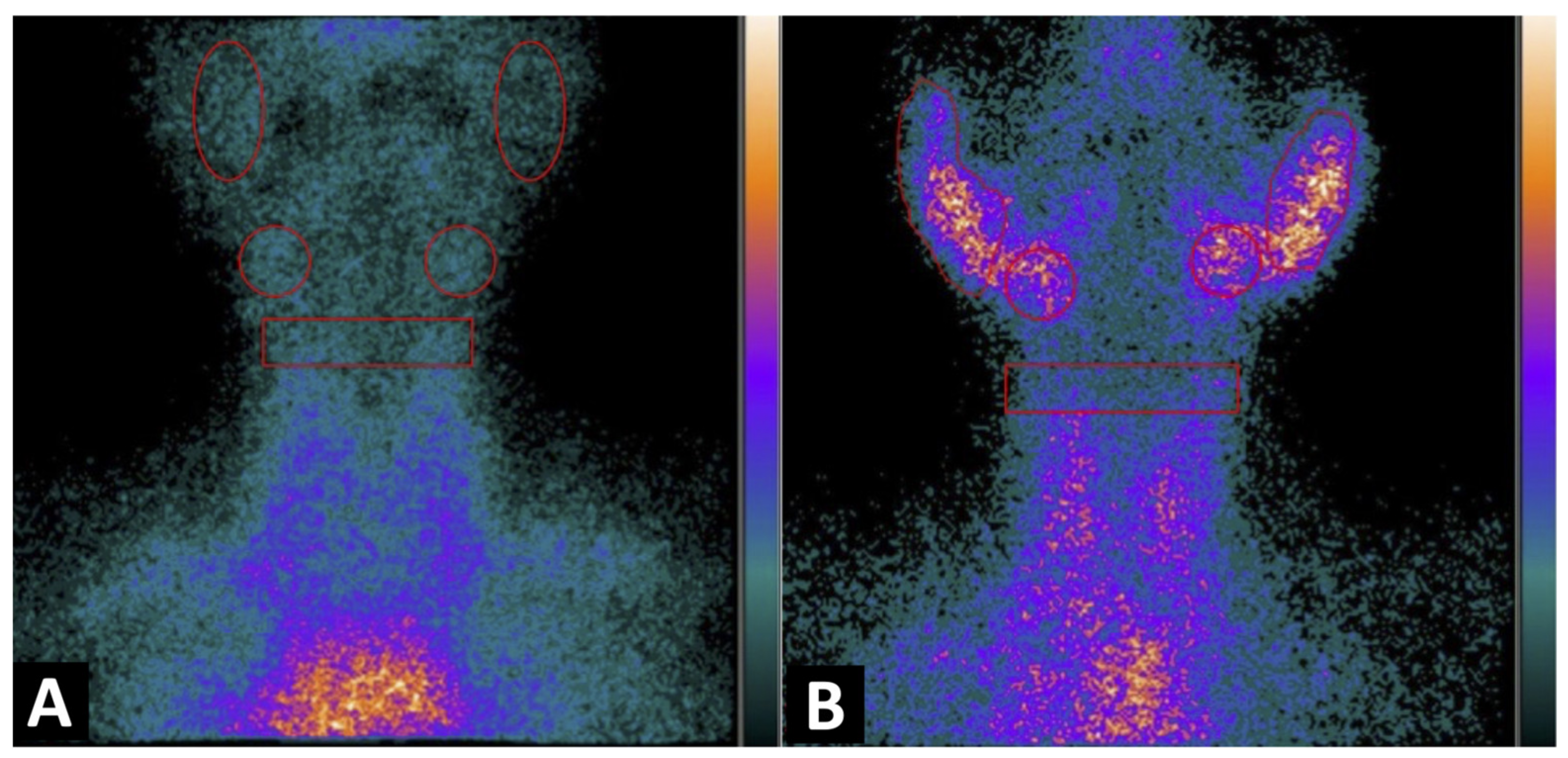 Imaging Activated-T-Lymphocytes in the Salivary Glands of