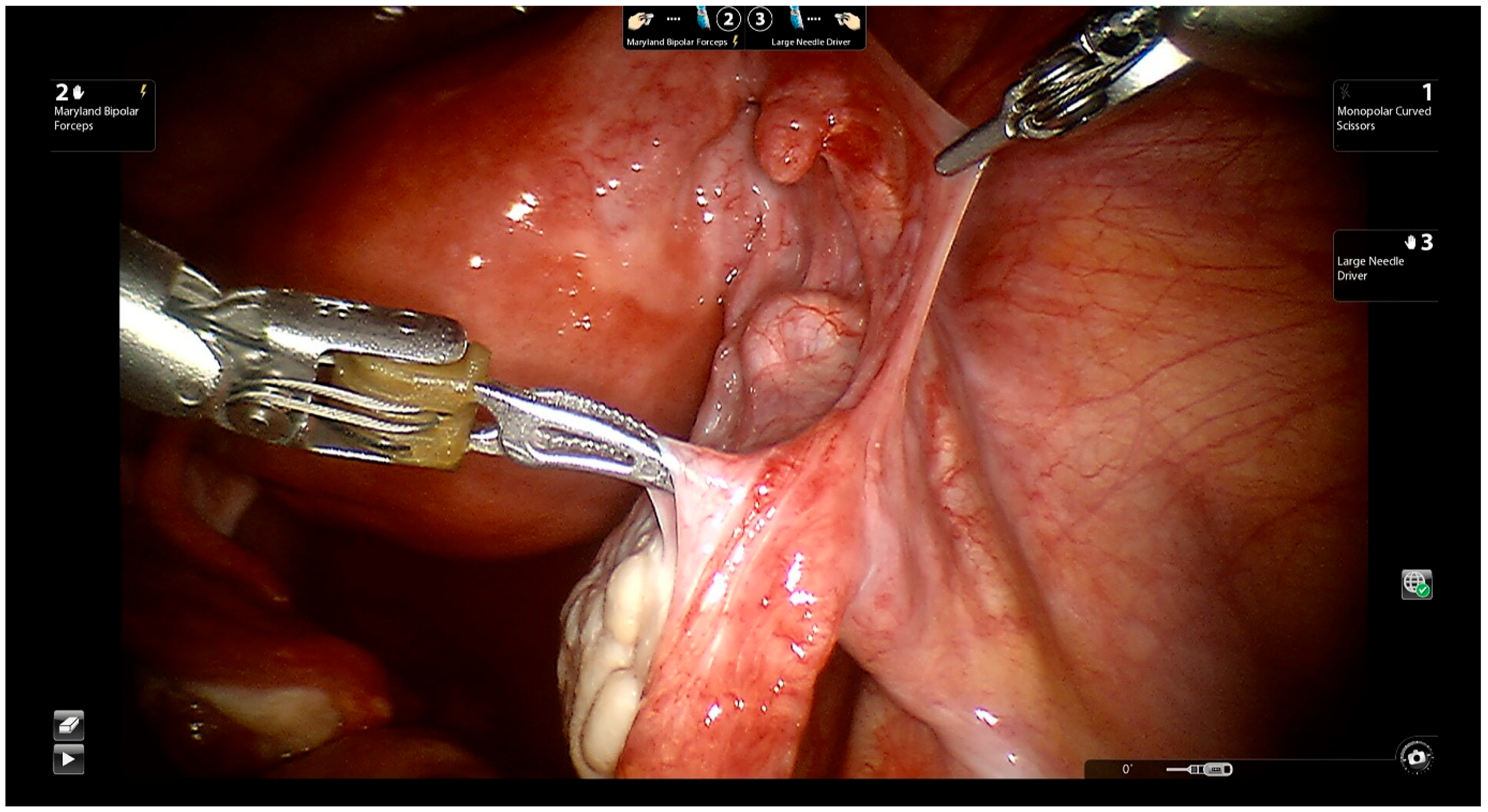 Jcm 11 04385 g004 Jcm 11 04385 g004