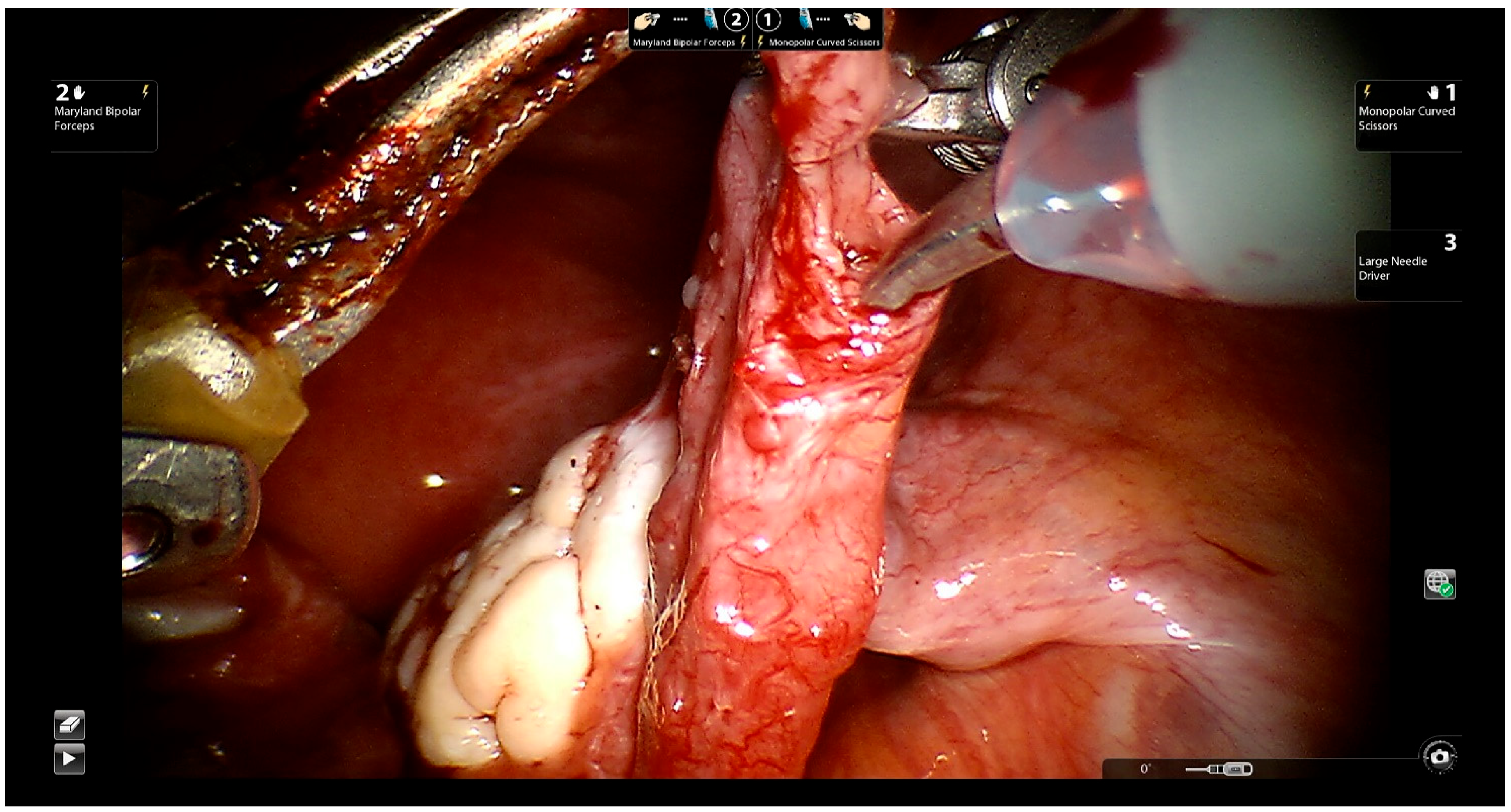 Jcm 11 04385 g005 Jcm 11 04385 g005