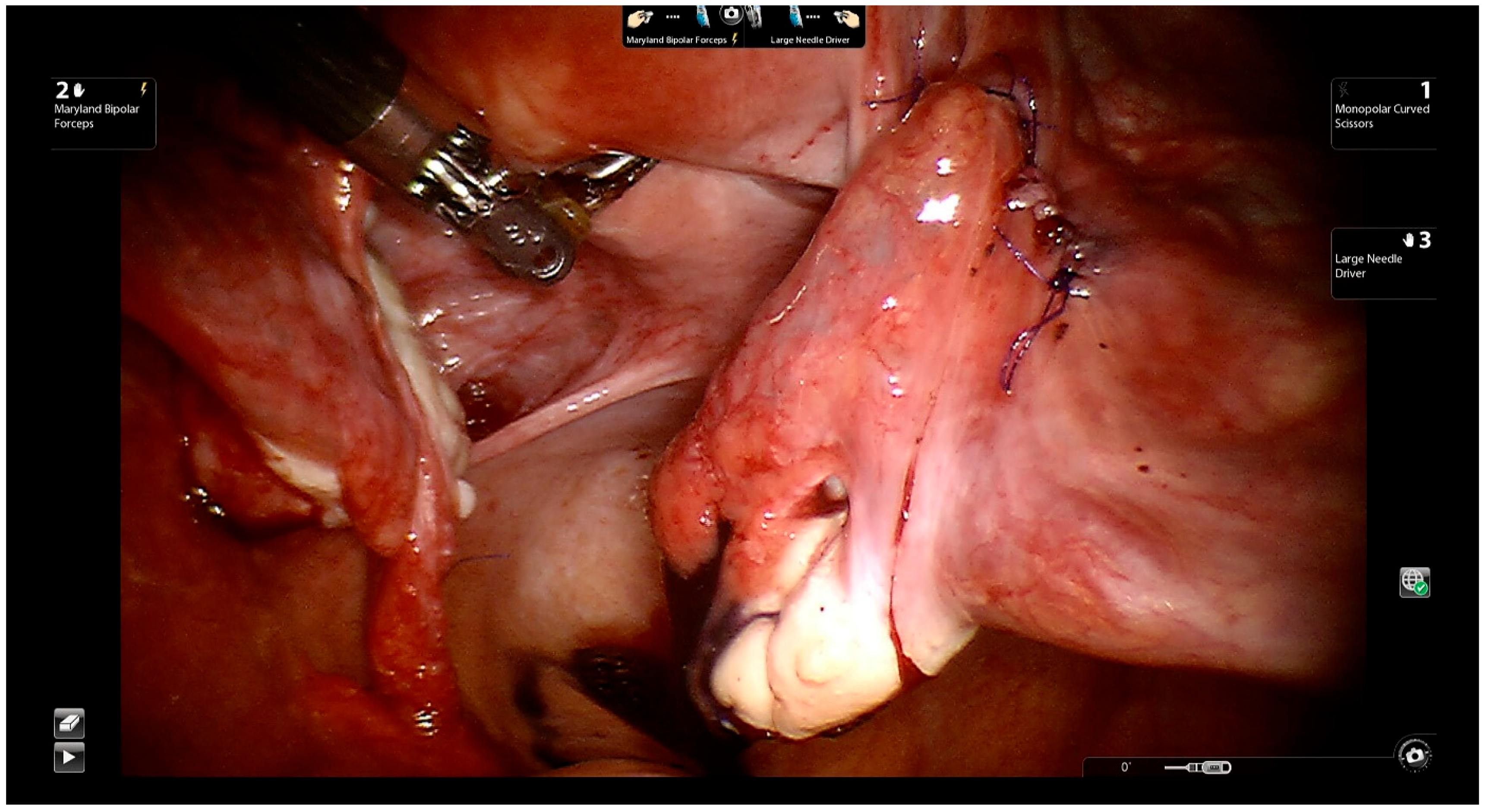 Jcm 11 04385 g006 Jcm 11 04385 g006