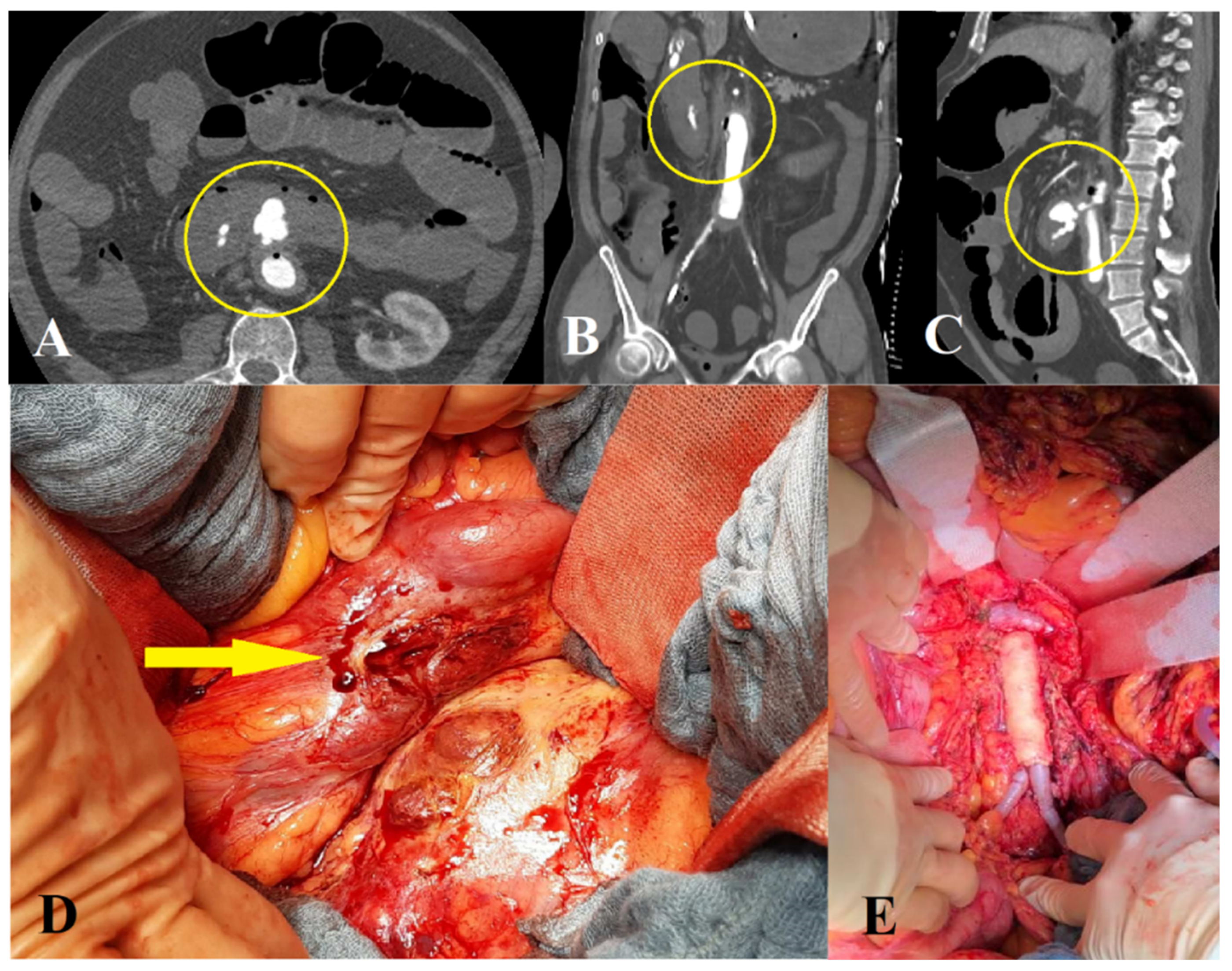 Jcm 11 04427 g003 550