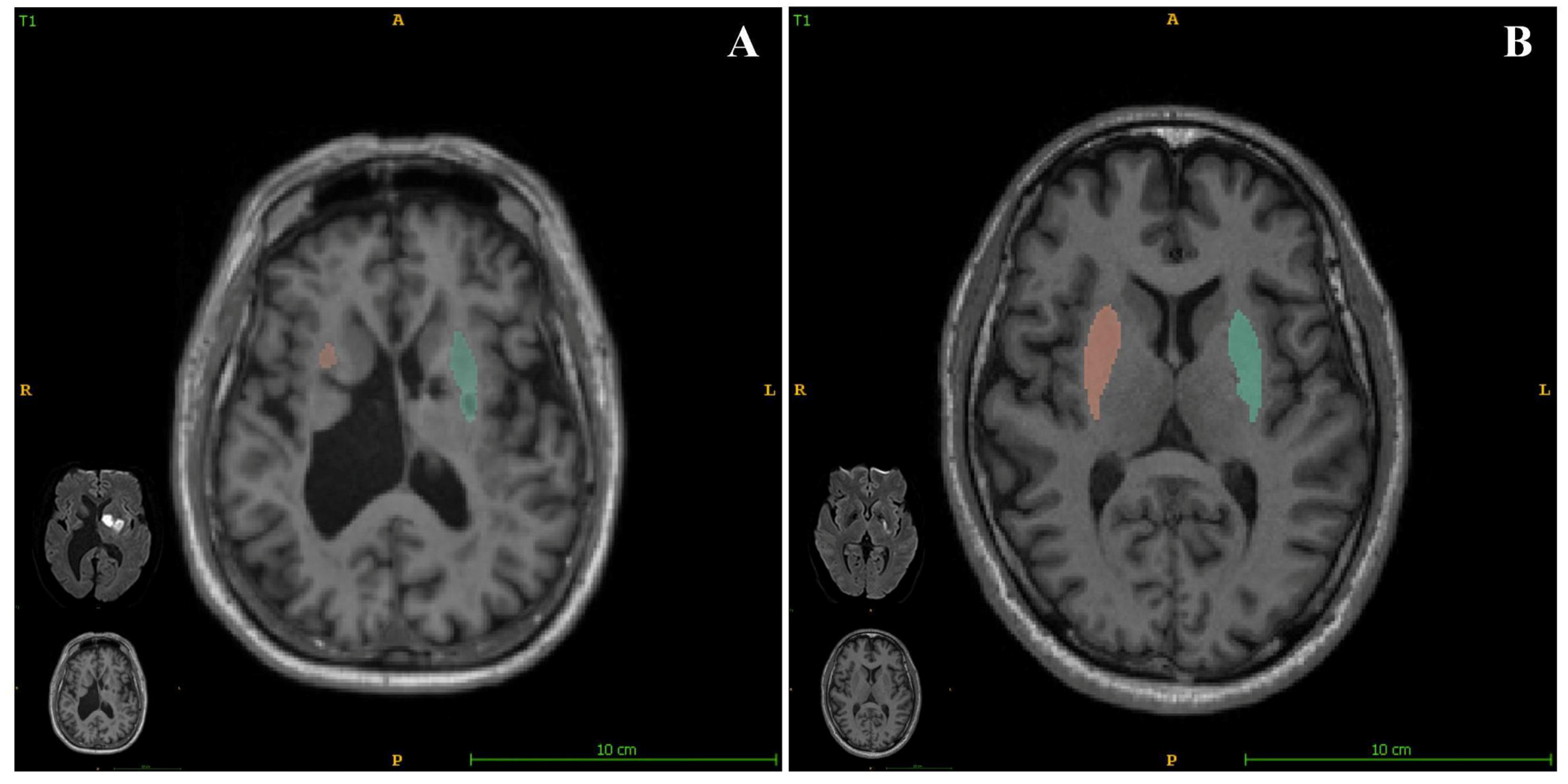 Jcm 11 04479 g003 550