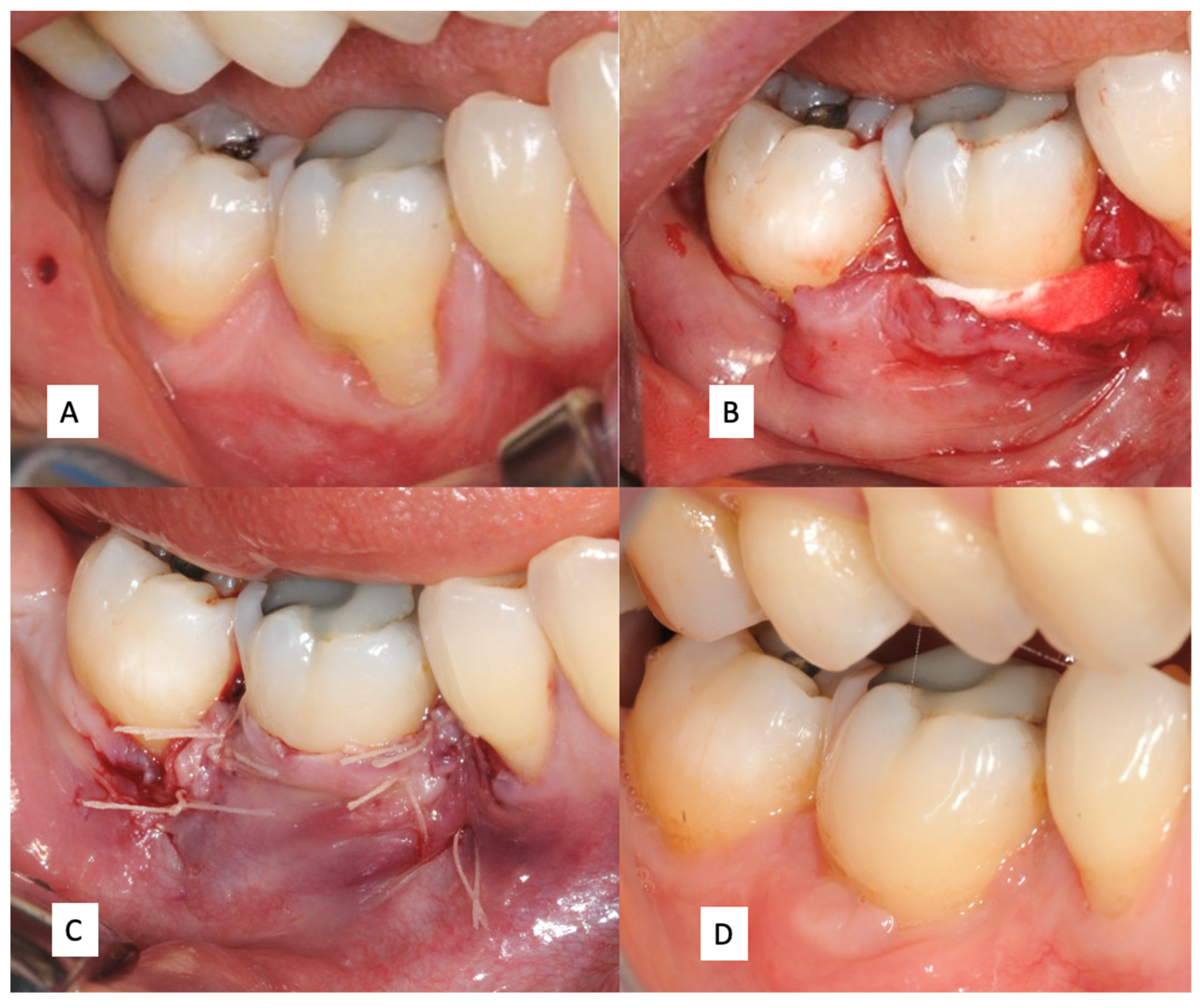 Jcm 11 04486 g001 550