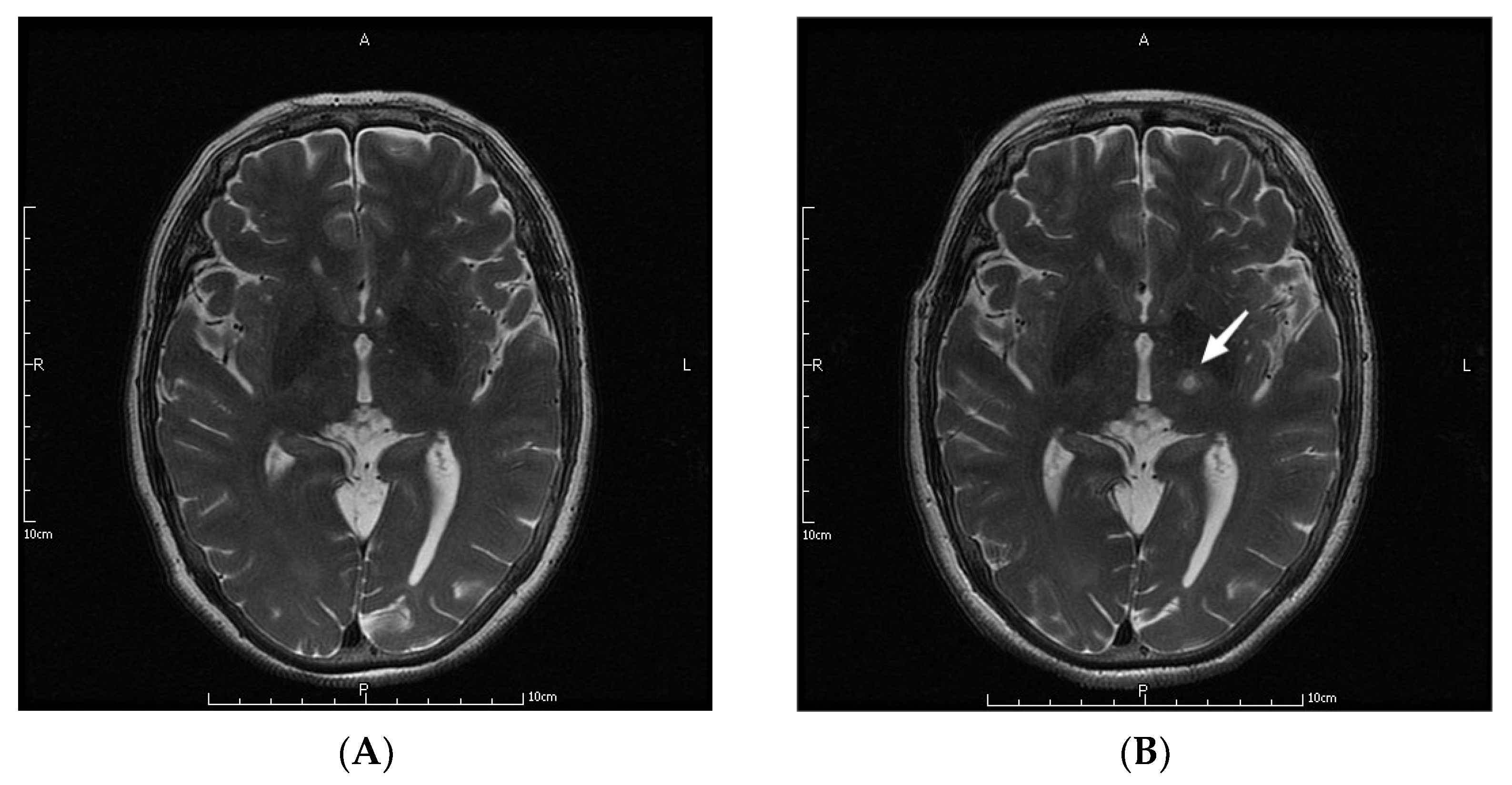 Jcm 11 04502 g001a 550