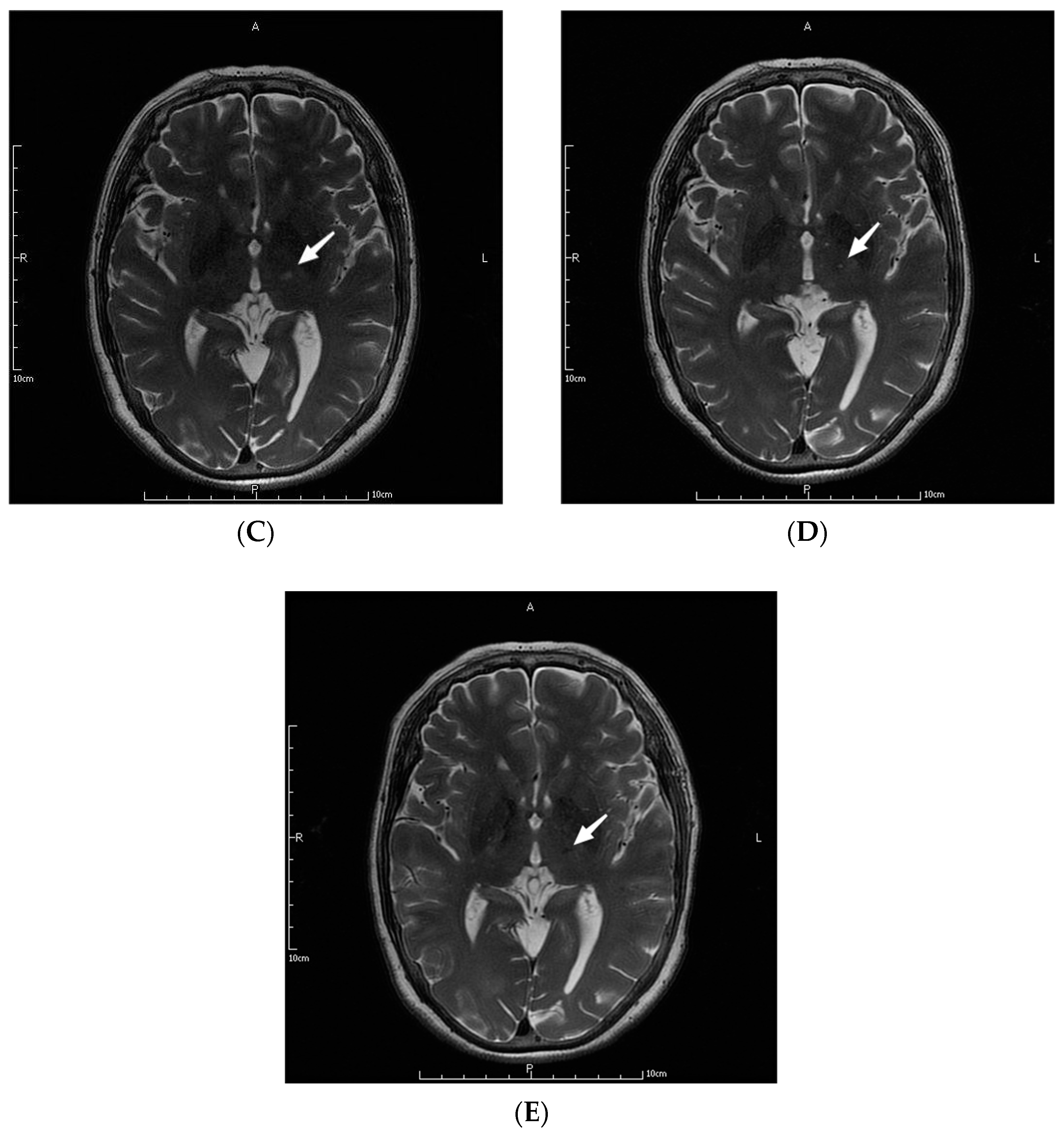 Jcm 11 04502 g001b 550