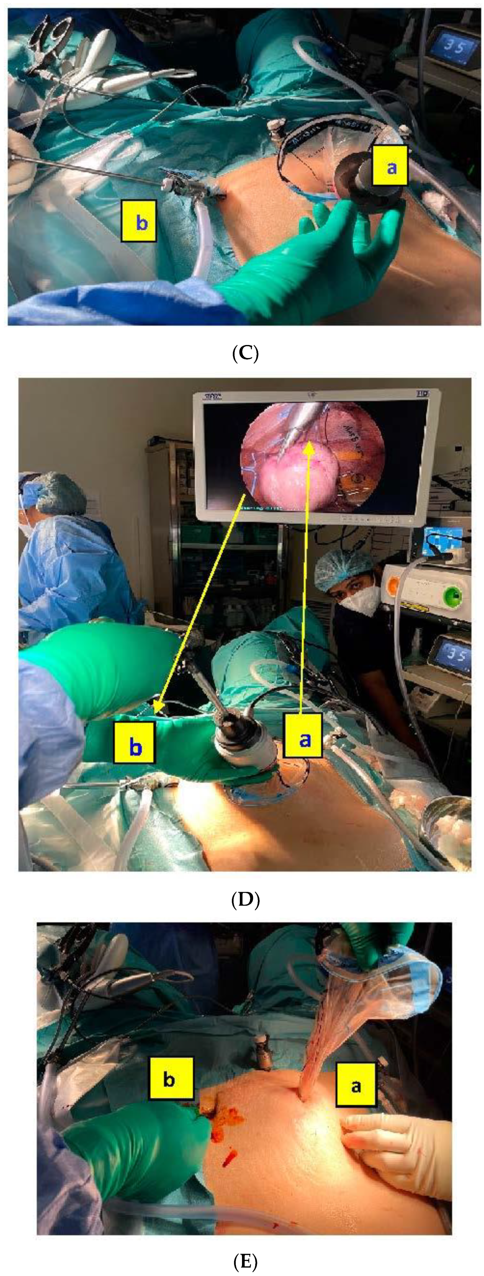 Jcm 11 04531 g002b 550