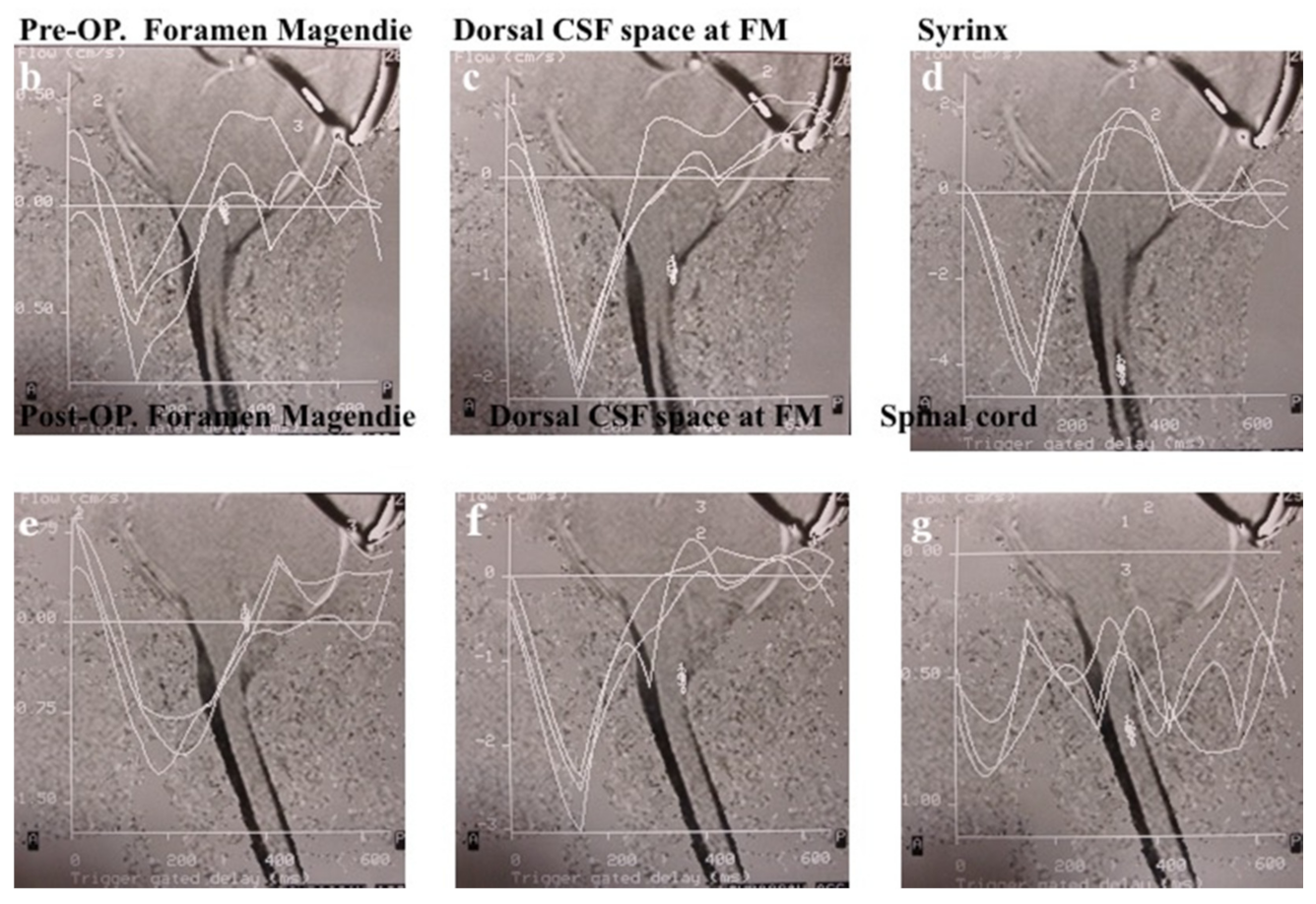 Jcm 11 04556 g005b Jcm 11 04556 g005b