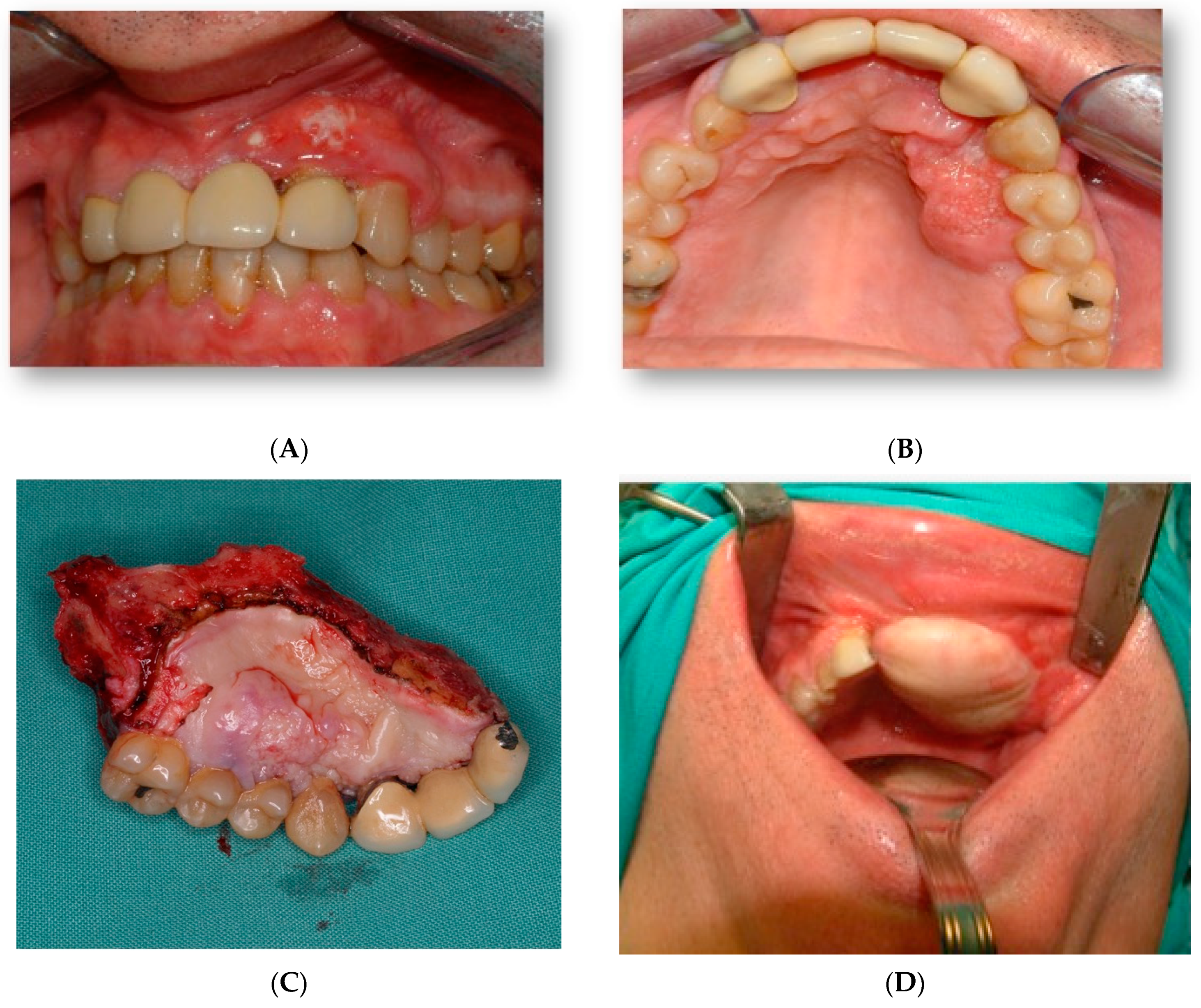 Jcm 11 04594 g001 550