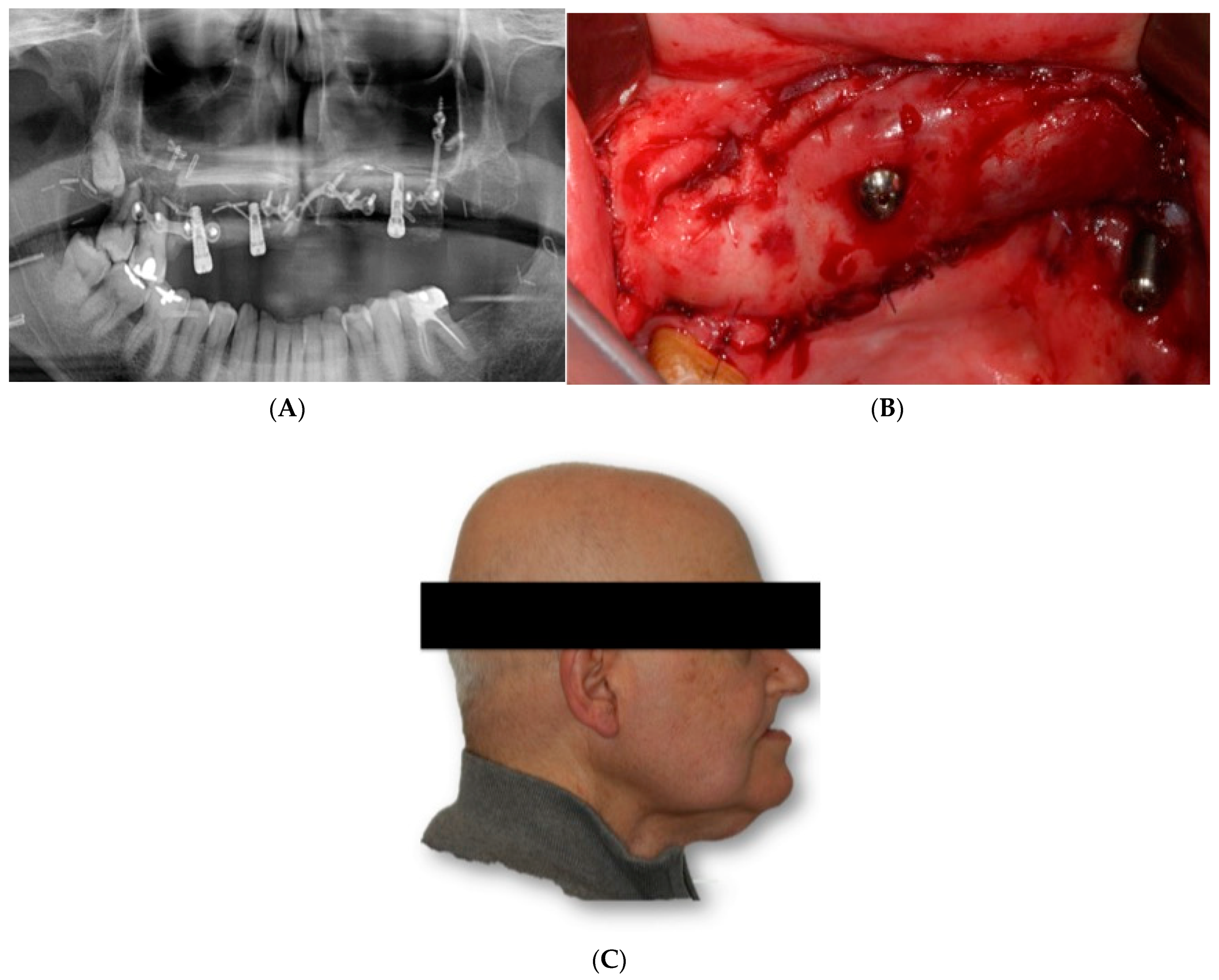 Jcm 11 04594 g002 550