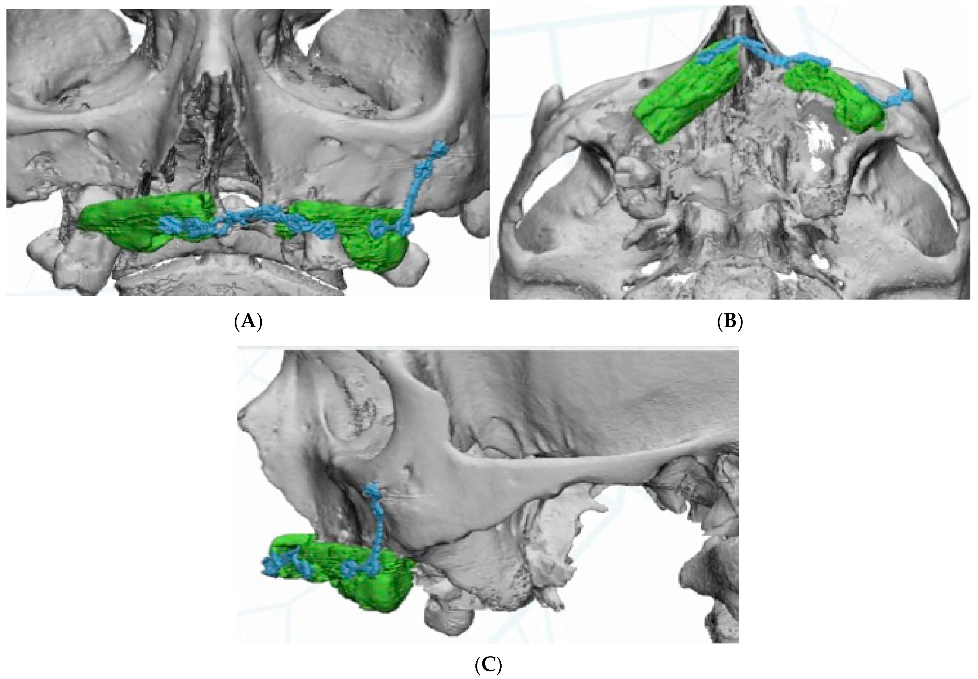 Jcm 11 04594 g003 550