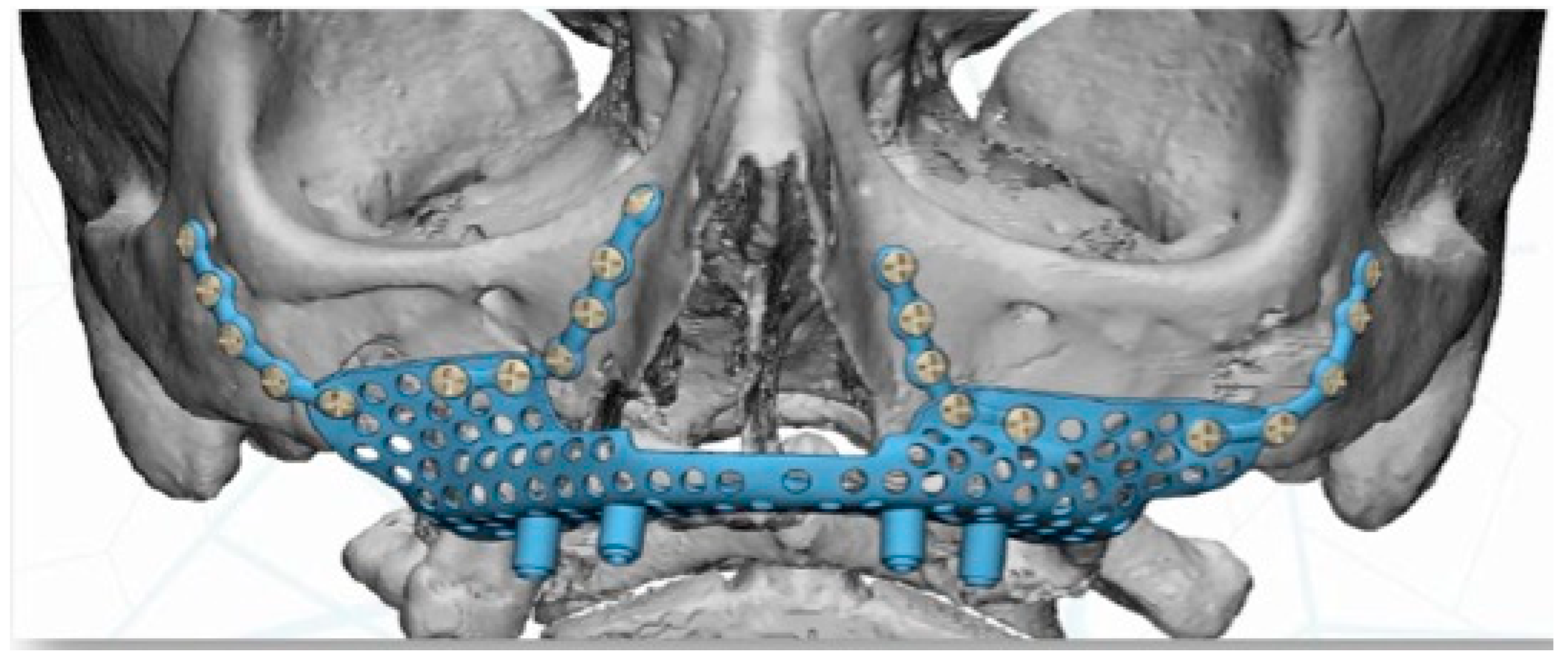 Jcm 11 04594 g005 550