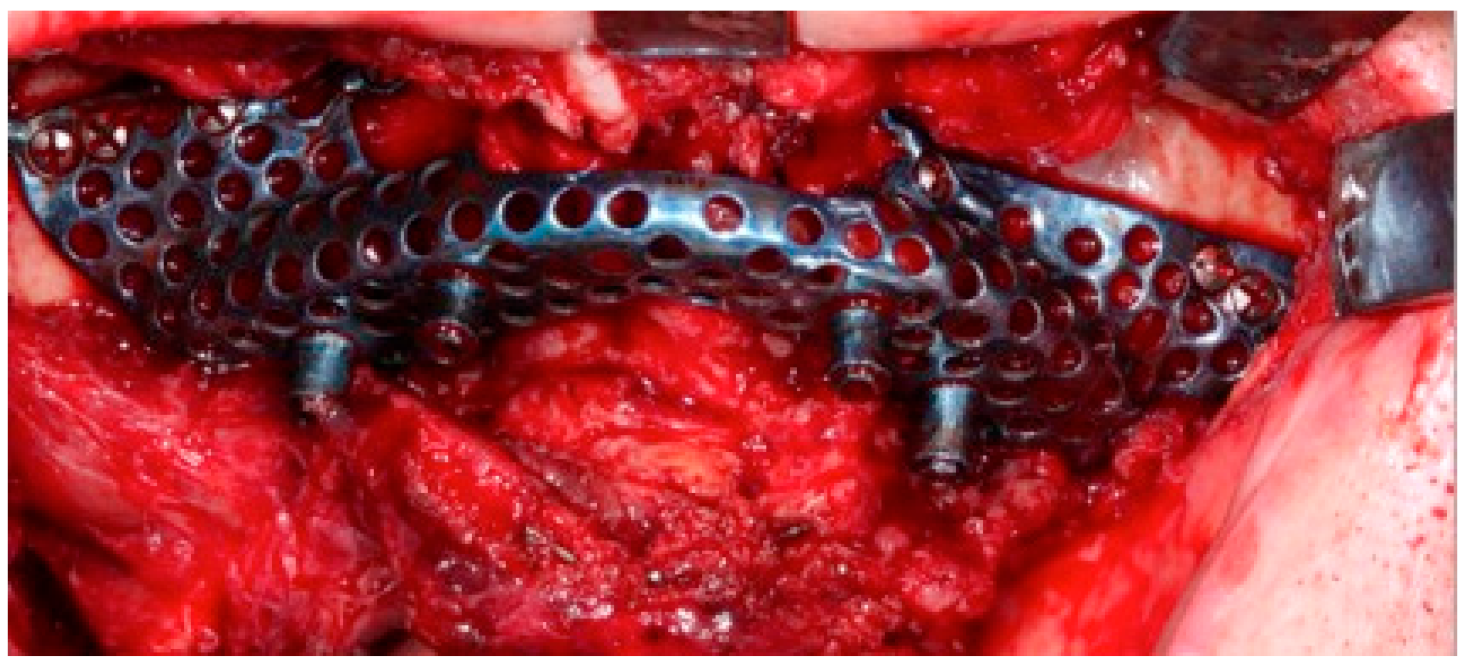 Jcm 11 04594 g006 550