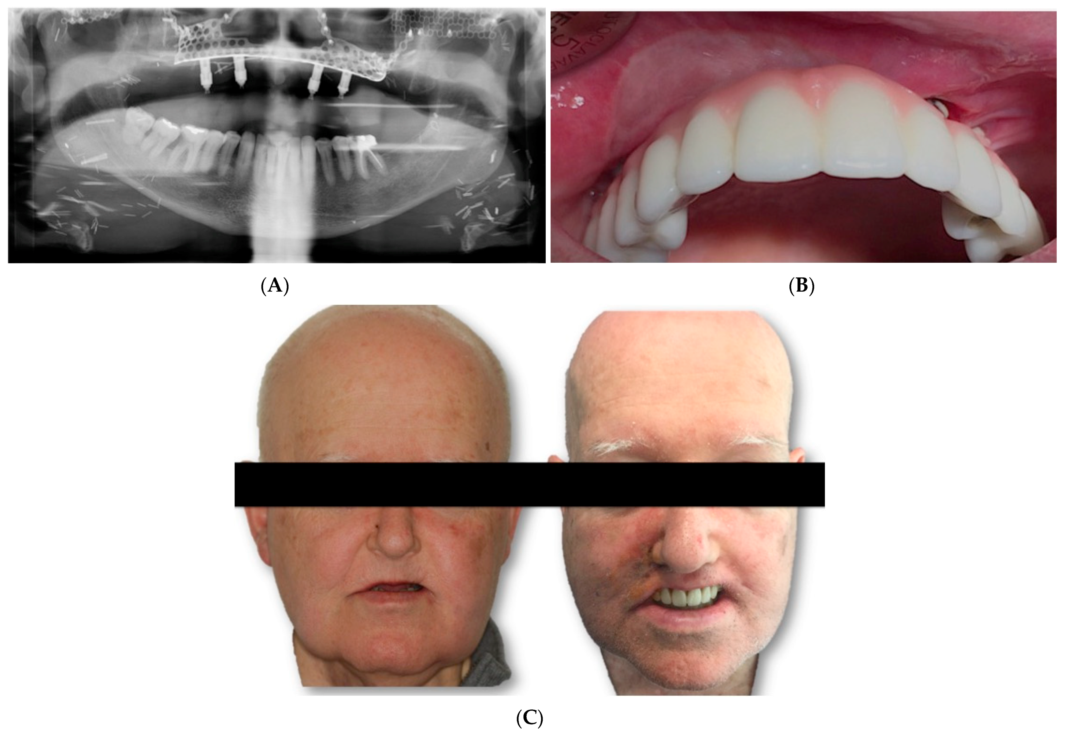 Jcm 11 04594 g007 550