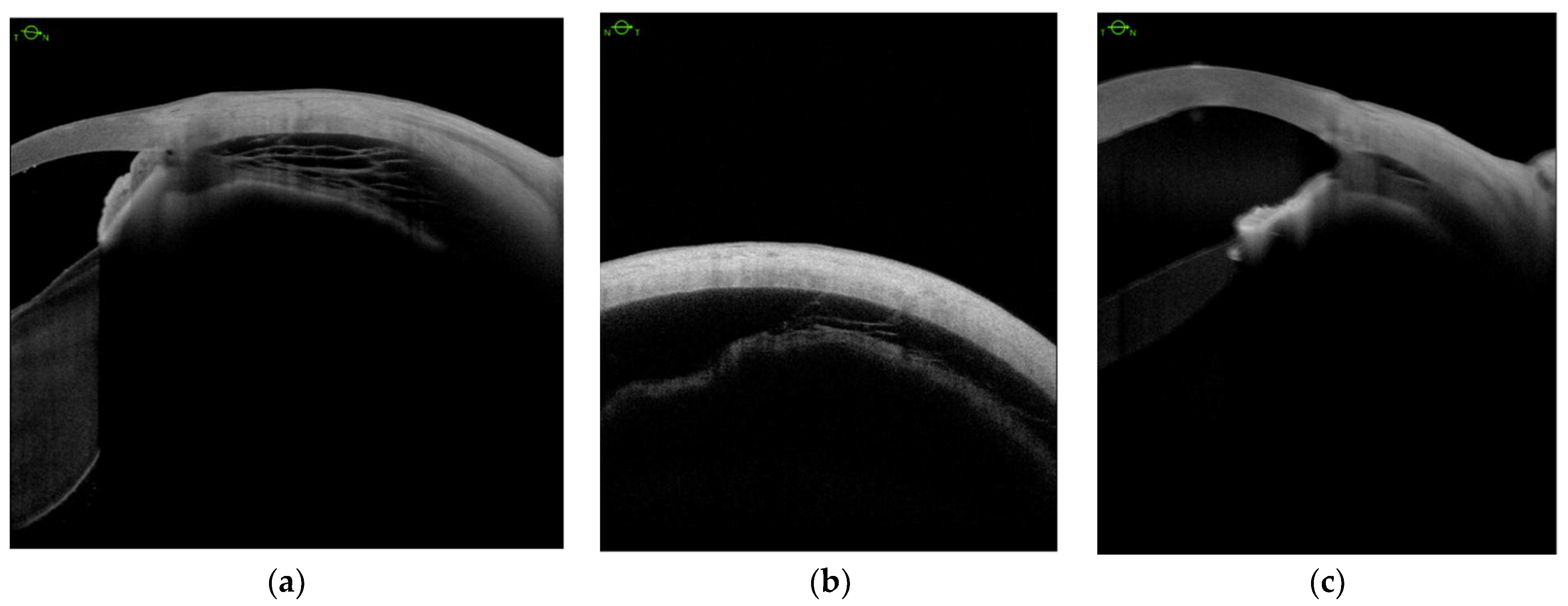 Jcm 11 04647 g002 550