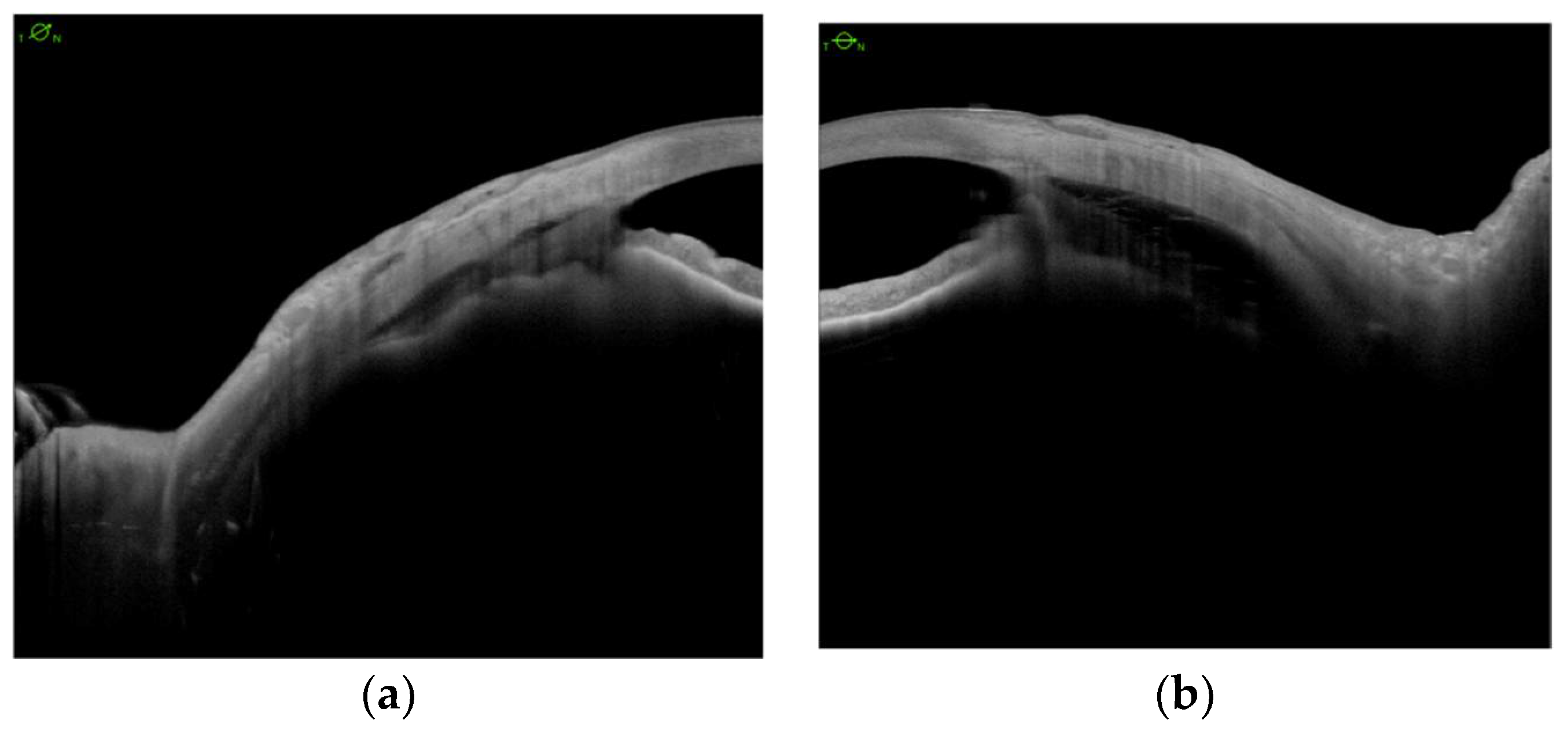 Jcm 11 04647 g003a 550