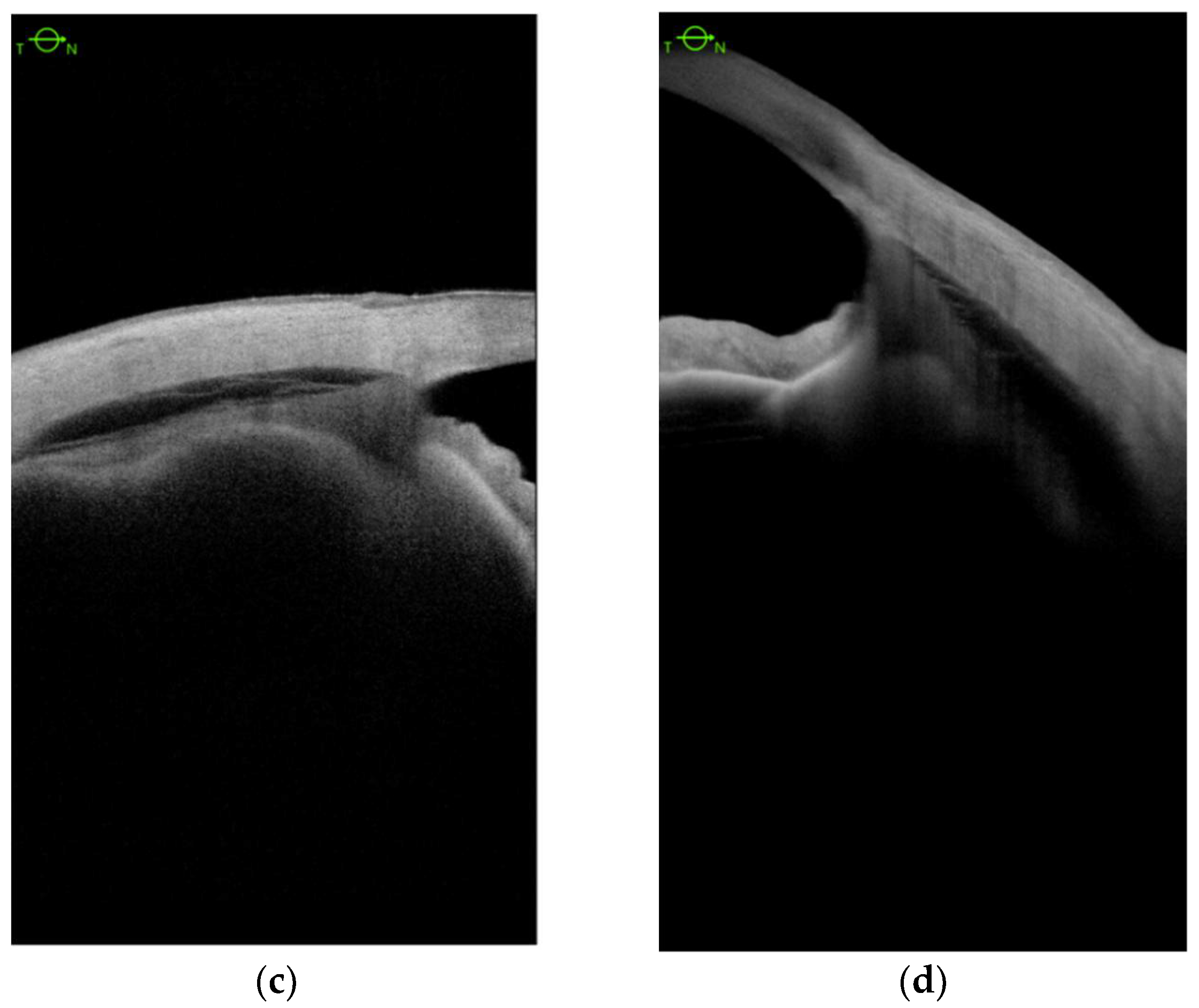 Jcm 11 04647 g003b 550