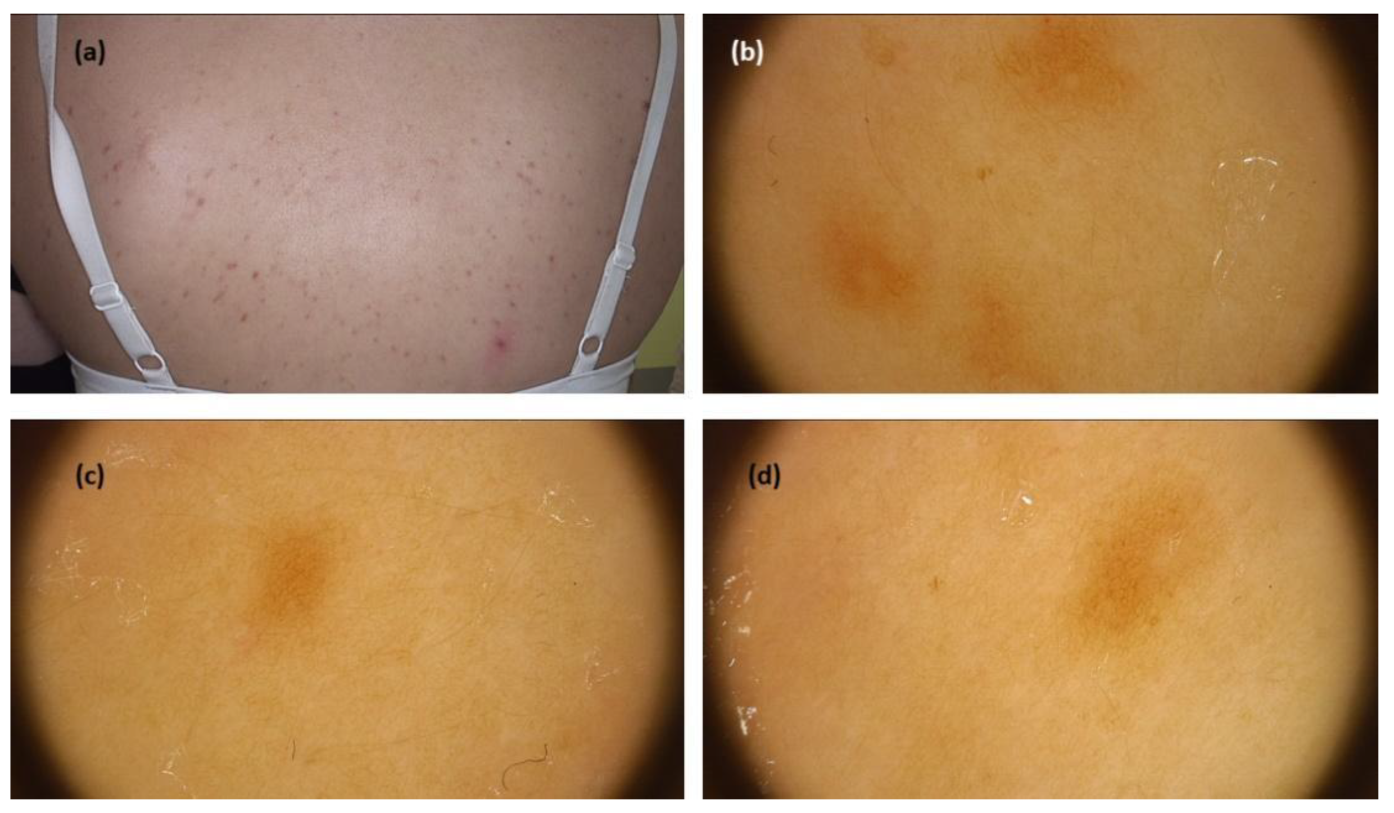 Jcm 11 04649 g002 550