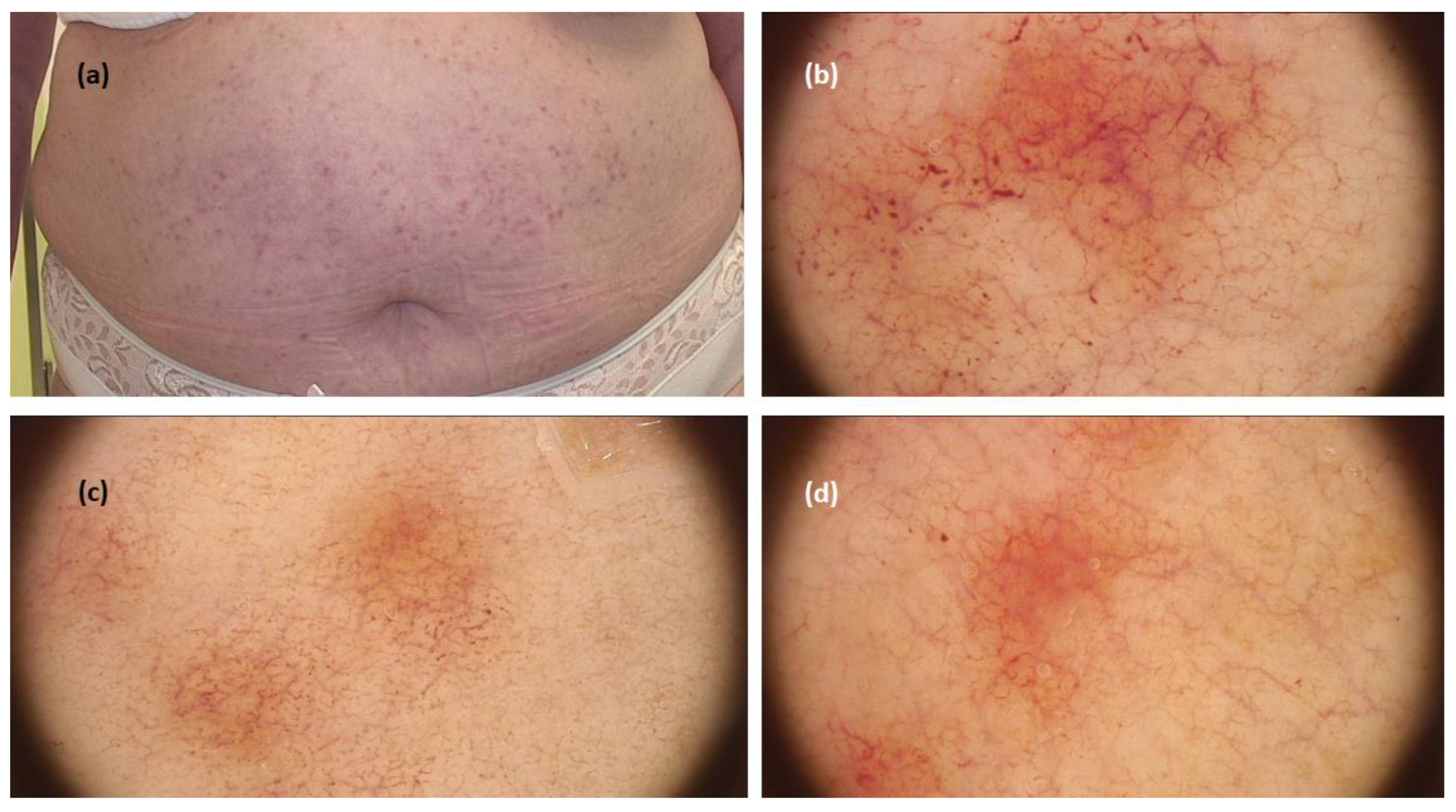 Jcm 11 04649 g003 550