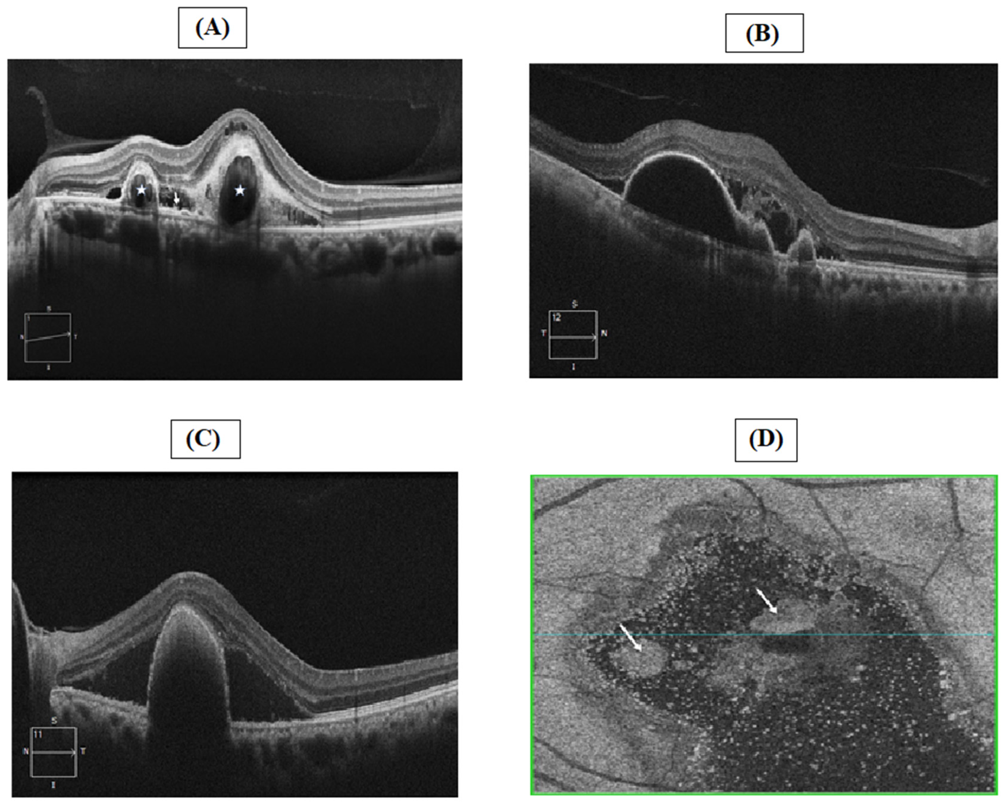 Jcm 11 04678 g004 550