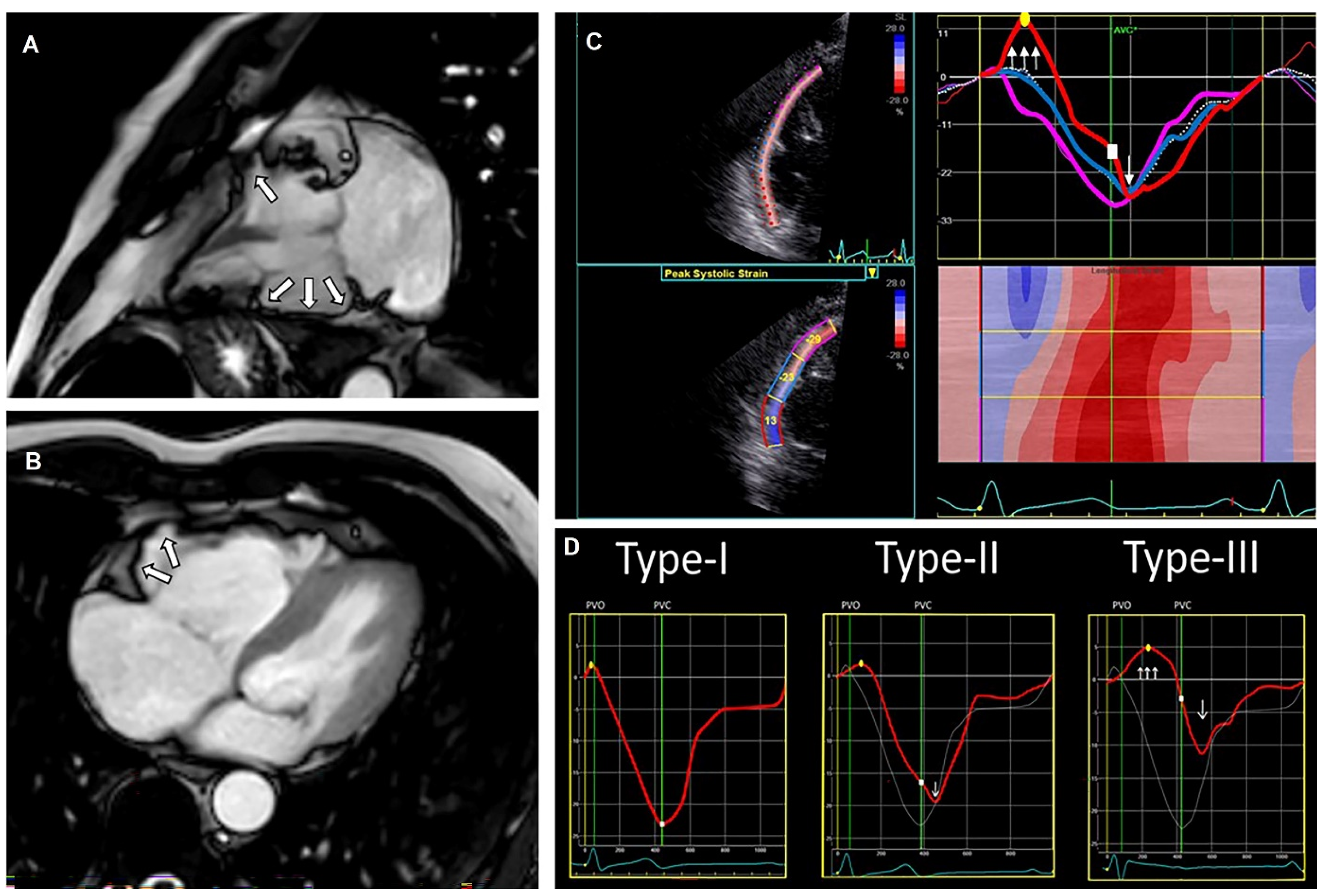Jcm 11 04680 g004 Jcm 11 04680 g004