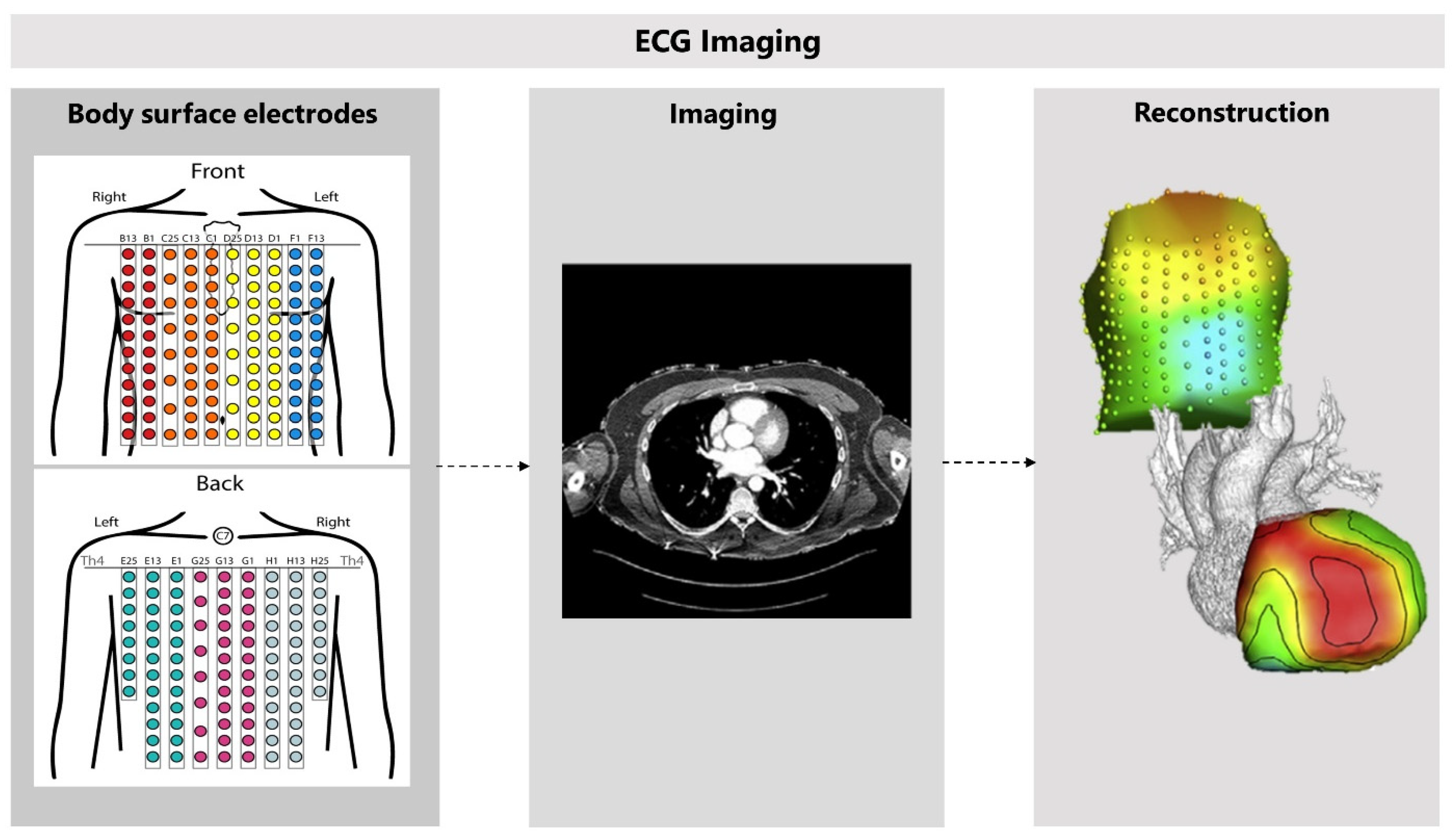 Jcm 11 04680 g008 Jcm 11 04680 g008