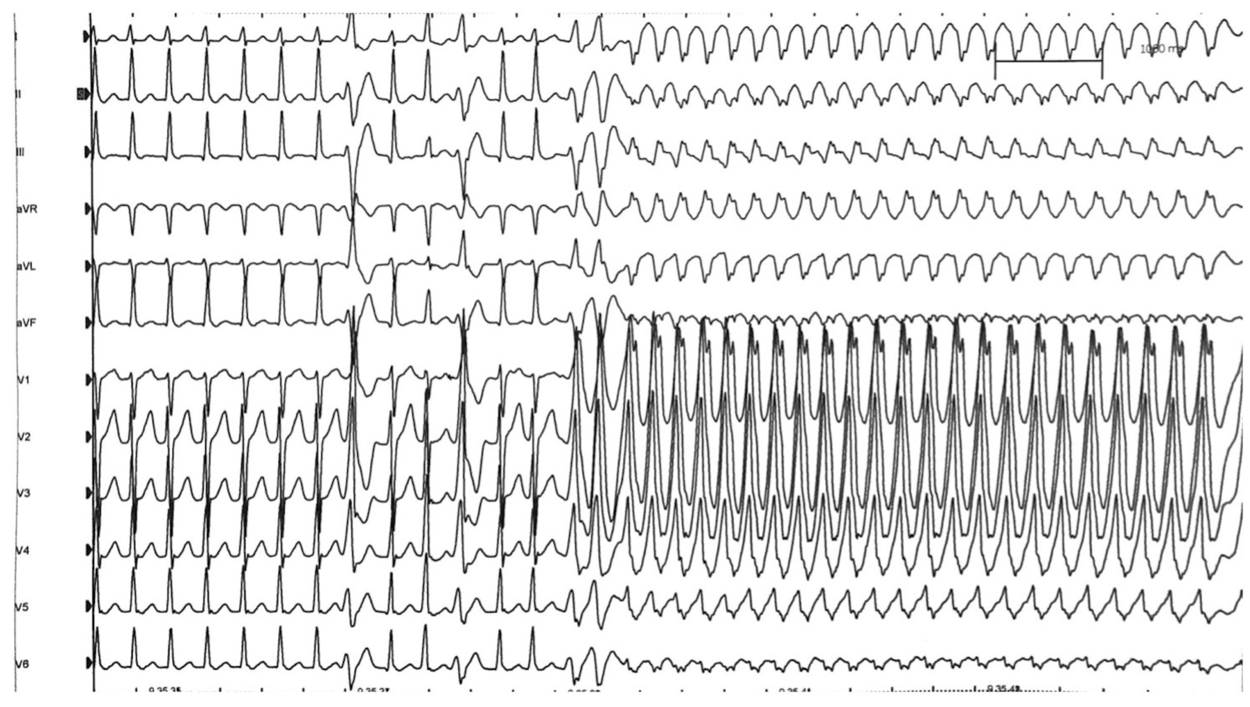 Jcm 11 04683 g004 550