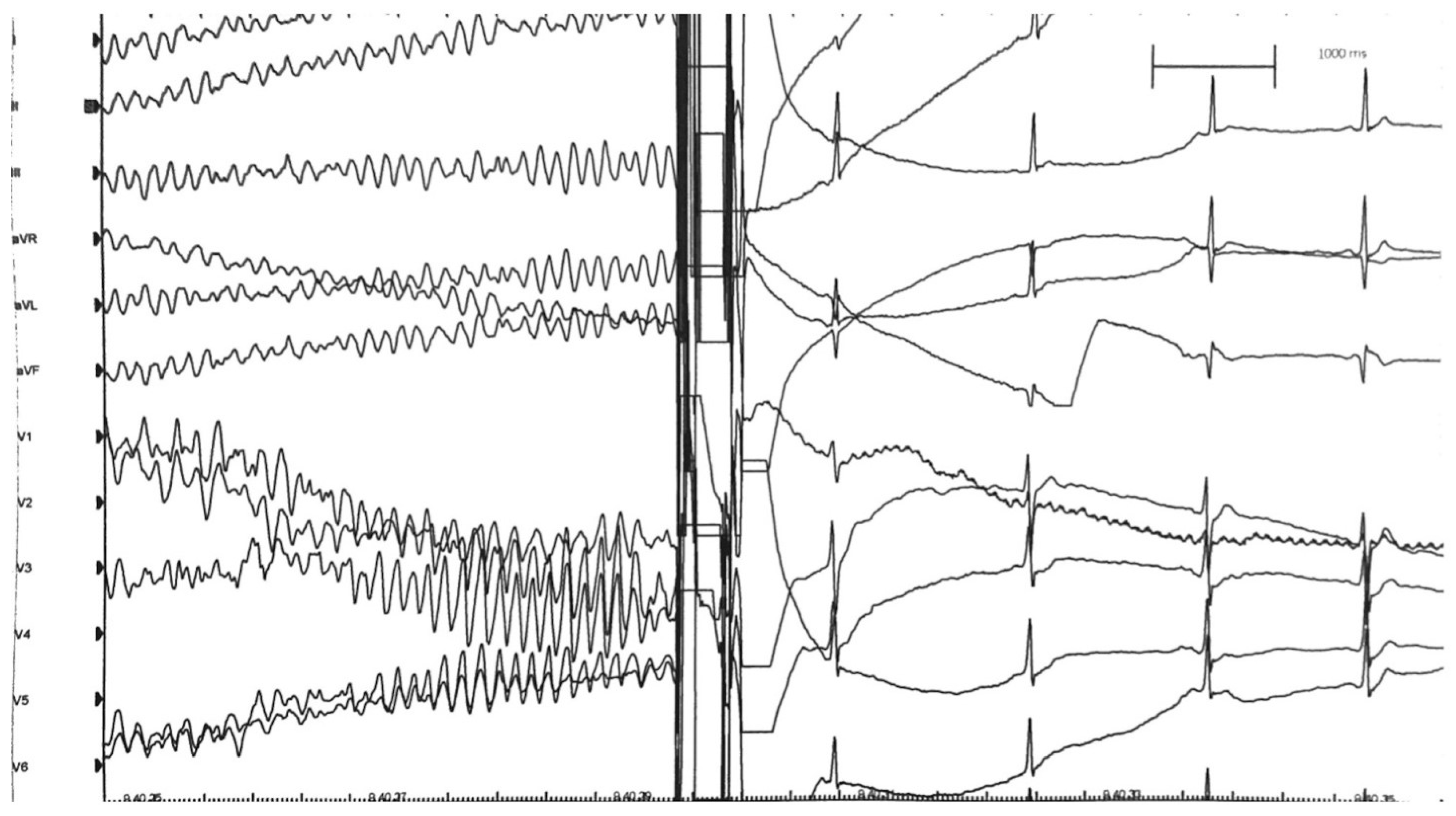Jcm 11 04683 g006 550