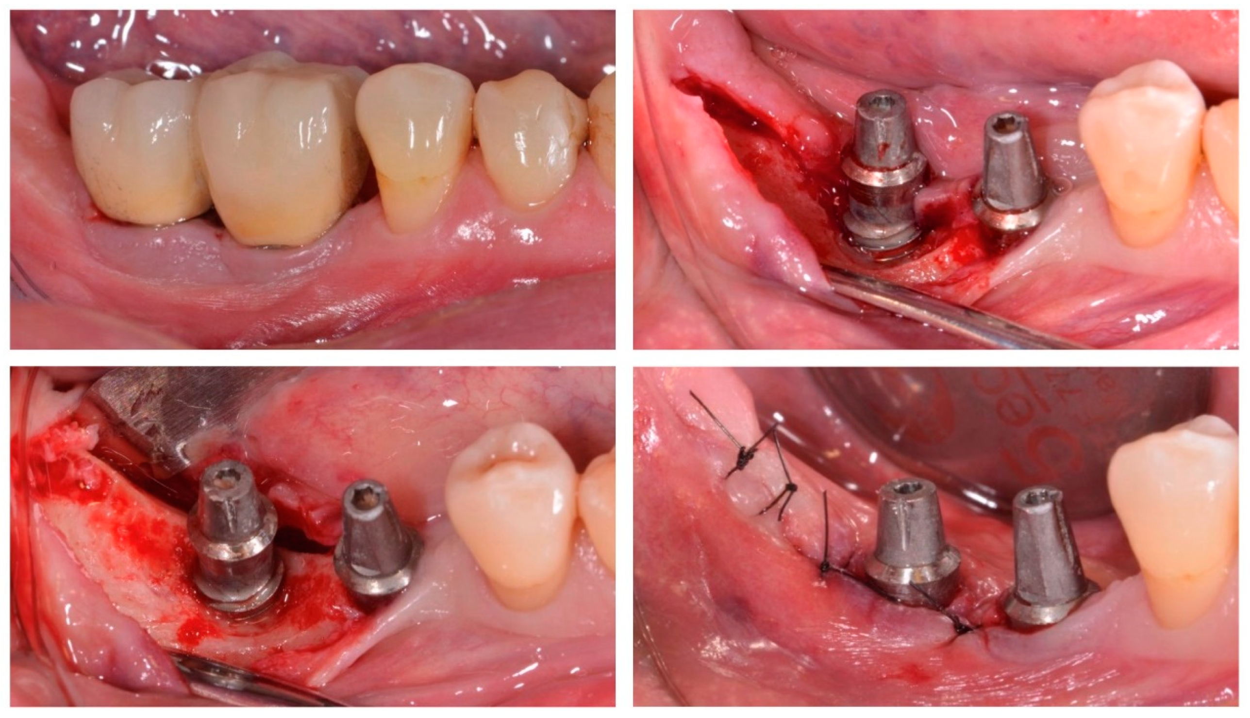 Jcm 11 04699 g001 Jcm 11 04699 g001