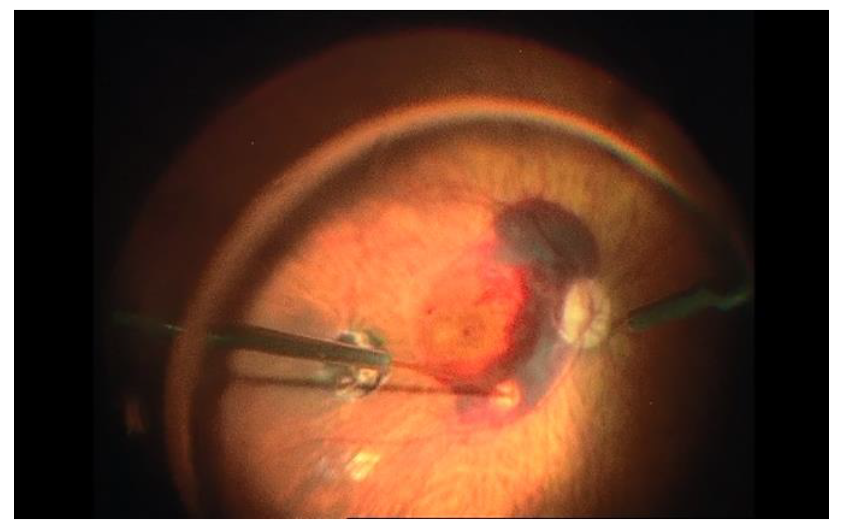 Jcm 11 04717 g003 550