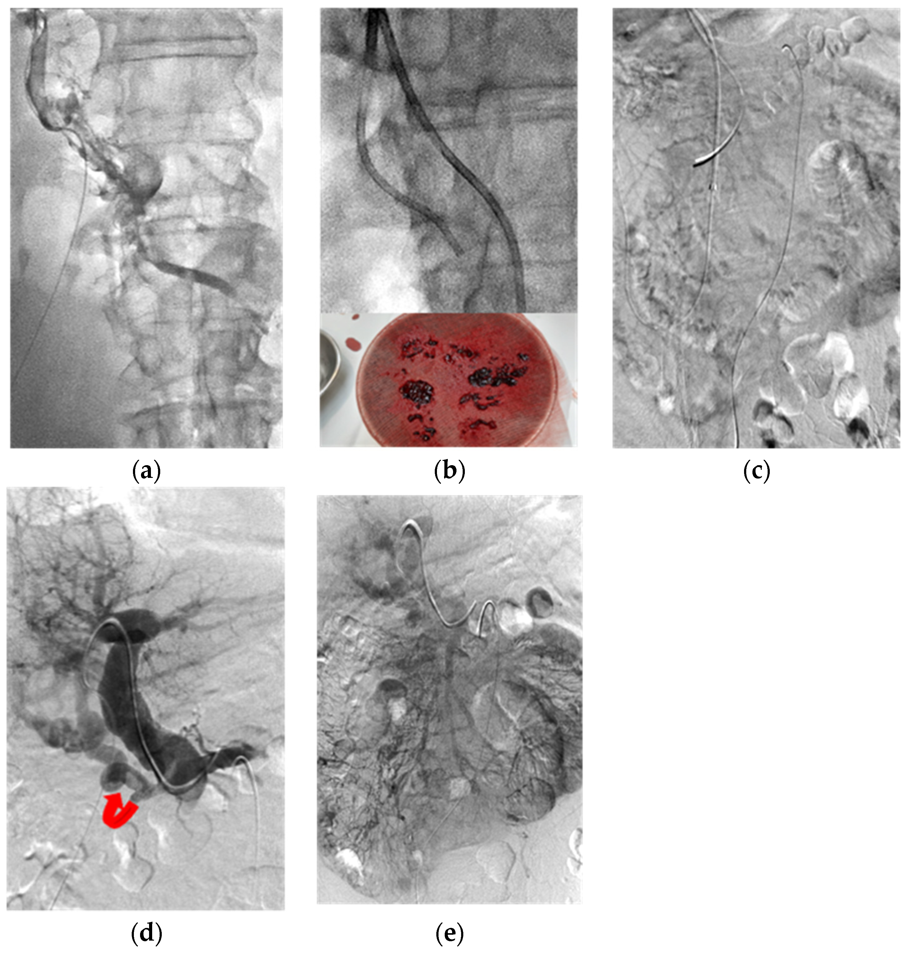 Jcm 11 04721 g003 550