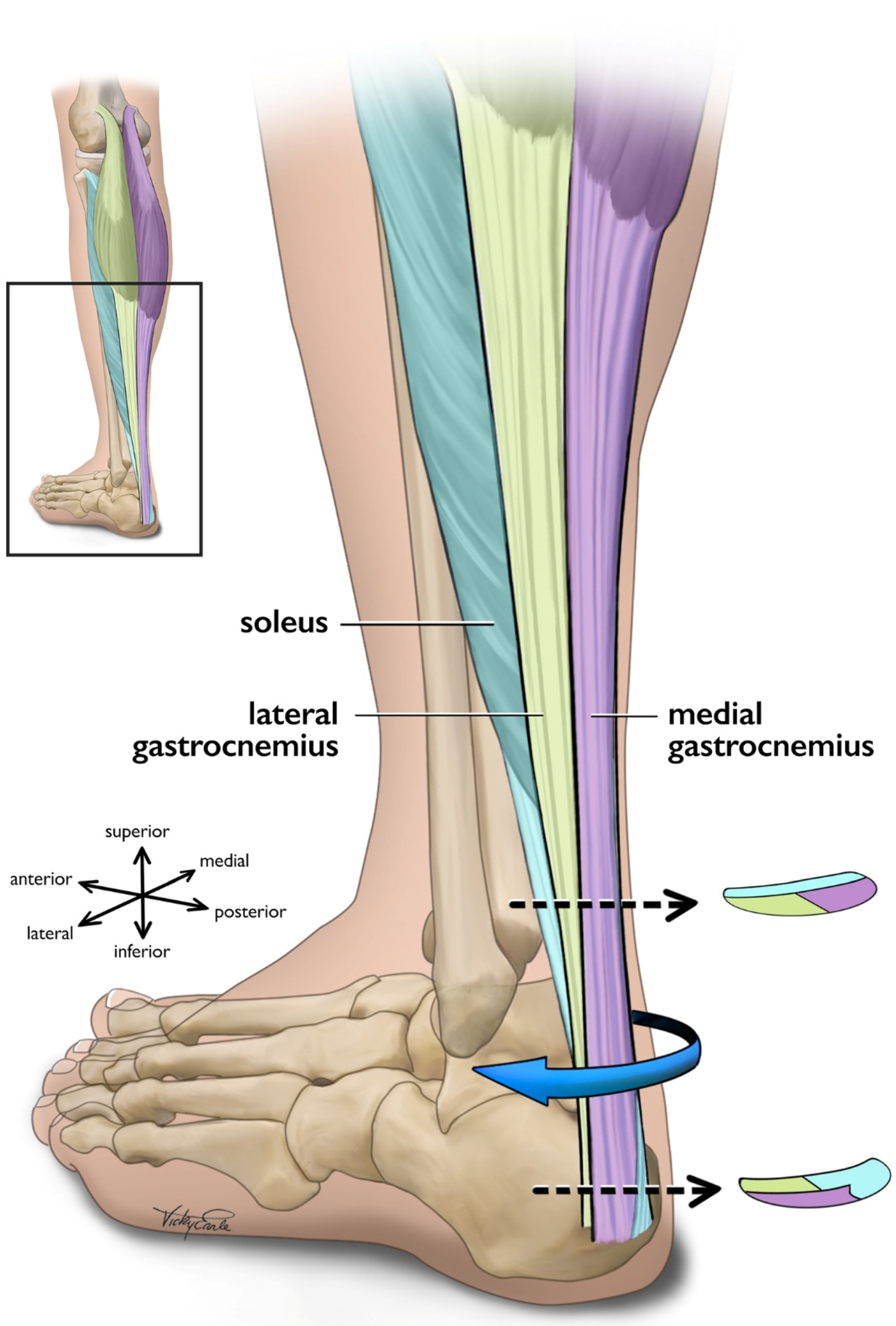 Achilles Tendonitis Printable Exercises [PDF] - Physio Ed.