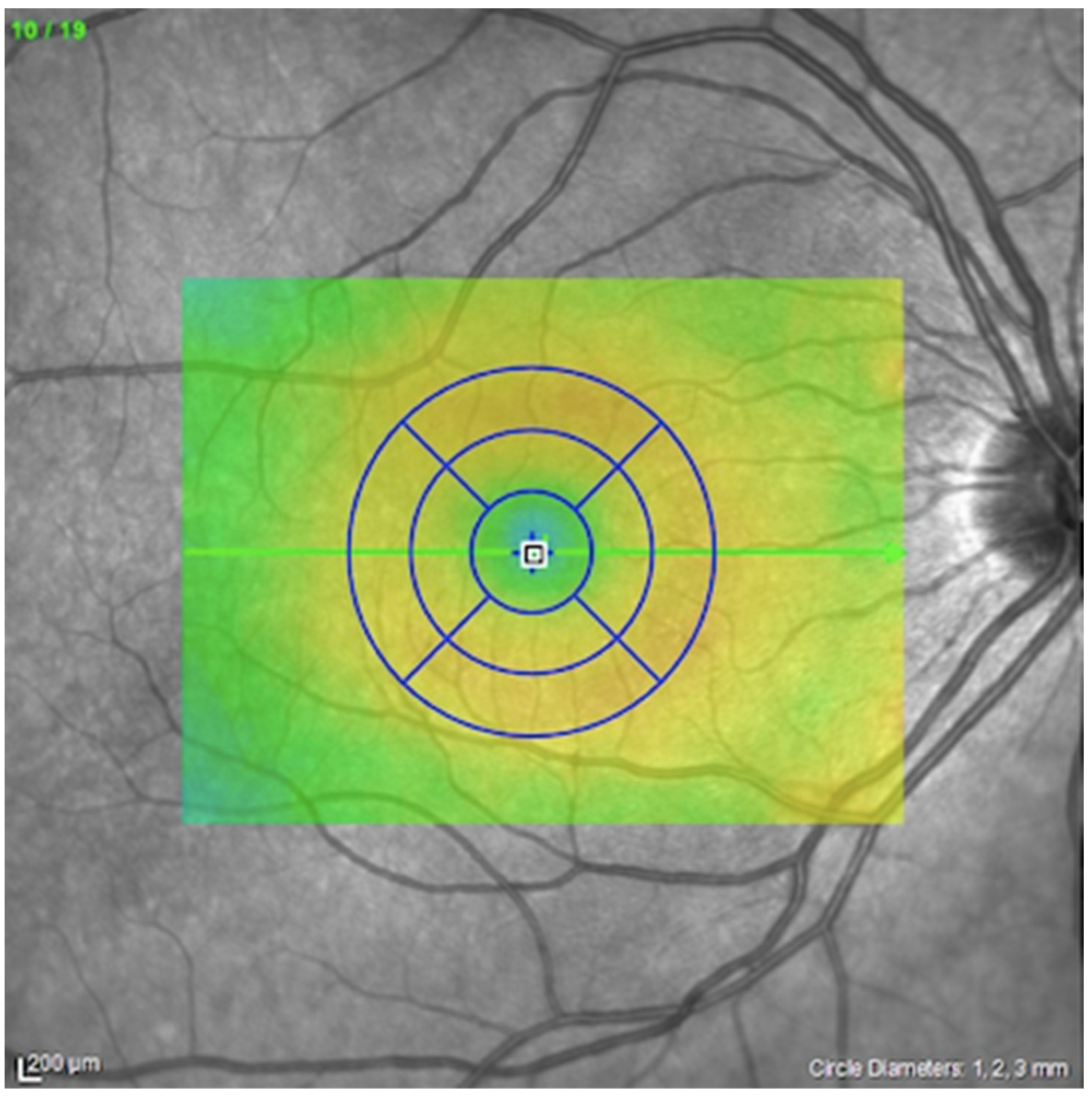 Jcm 11 04727 g002 550