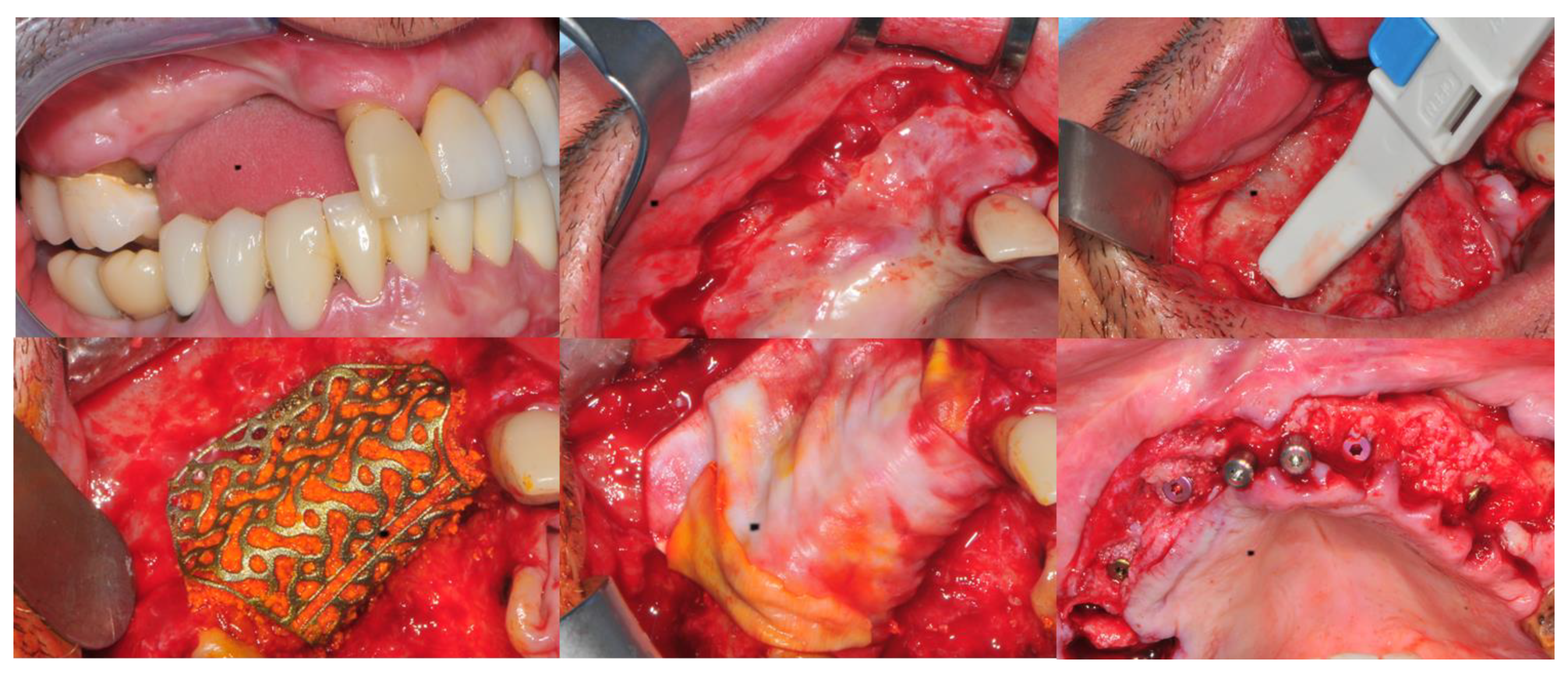 Jcm 11 04739 g002 550