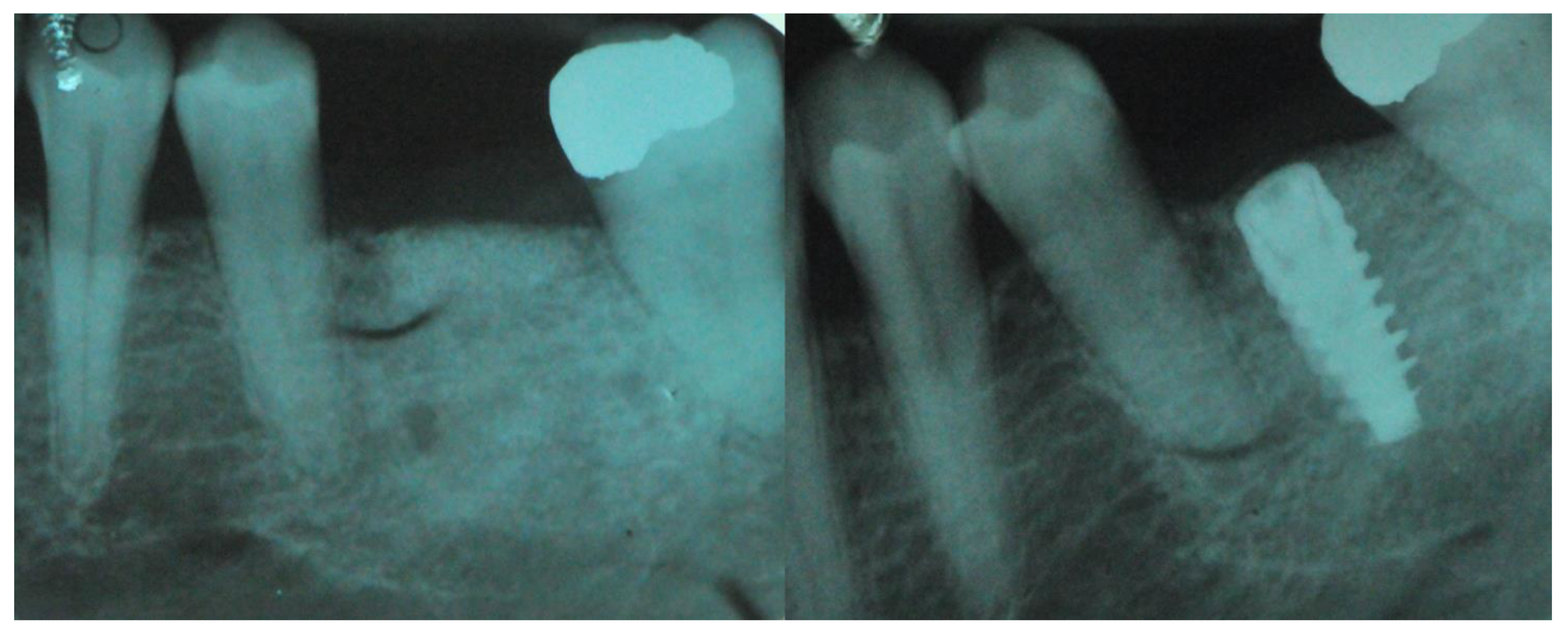 Jcm 11 04739 g005 550