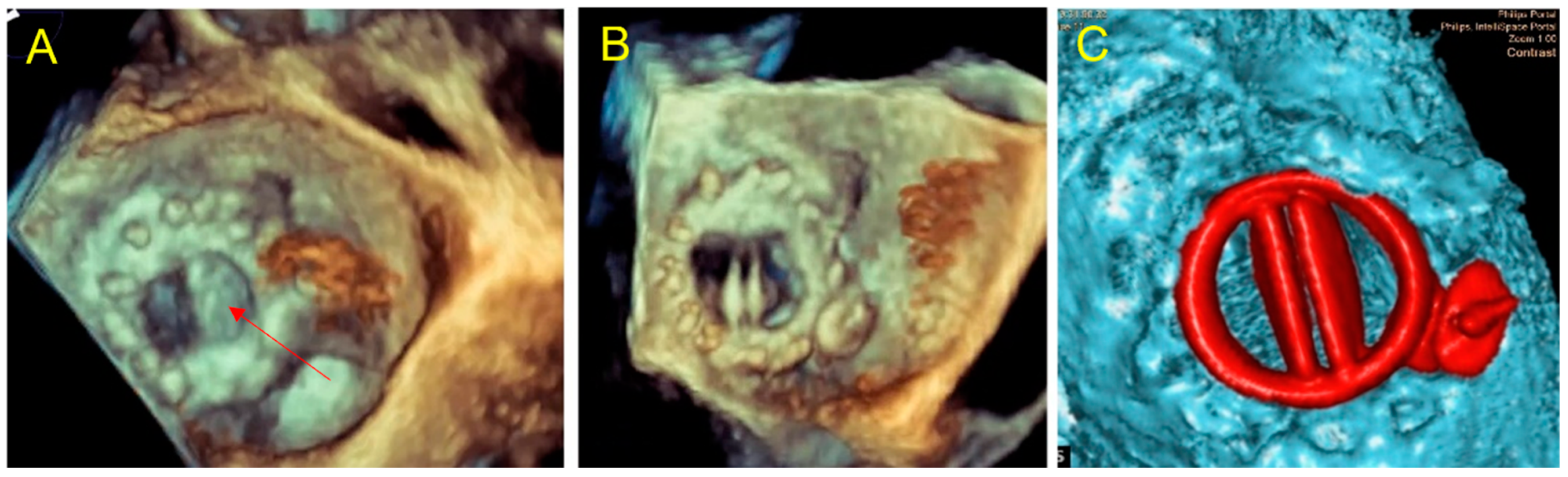 Jcm 11 04758 g004 550
