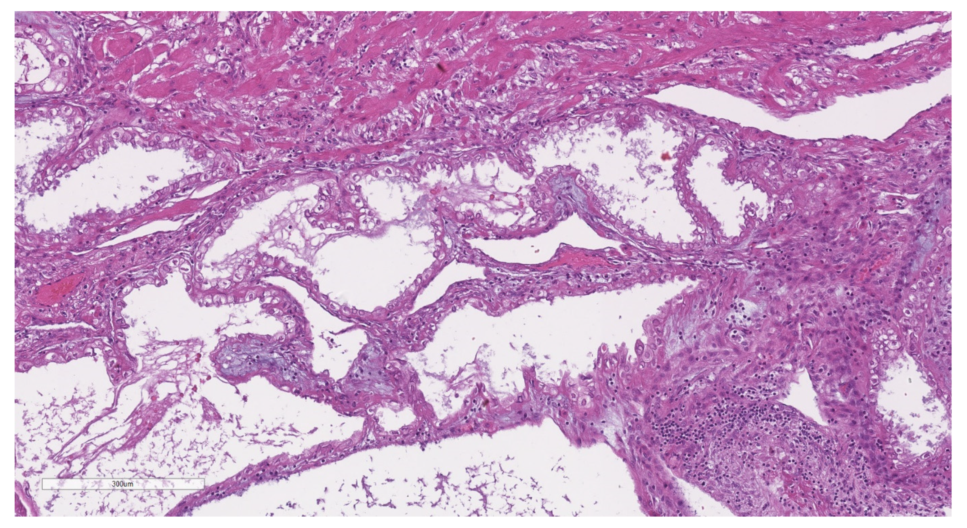 Jcm 11 04814 g005 Jcm 11 04814 g005