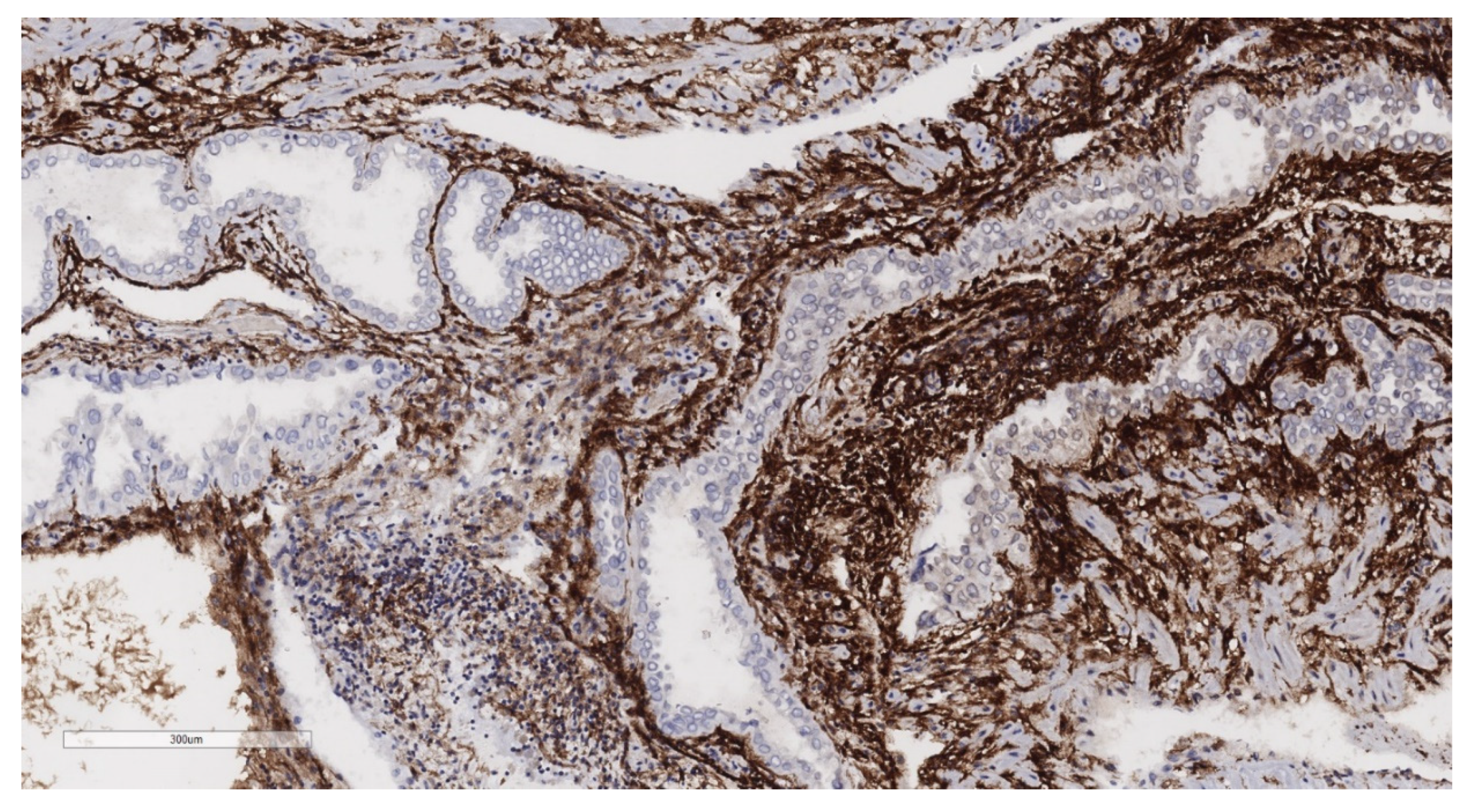 Jcm 11 04814 g006 Jcm 11 04814 g006