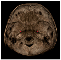 Jcm 11 04887 i001 Jcm 11 04887 i001