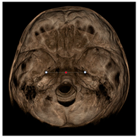 Jcm 11 04887 i002 Jcm 11 04887 i002